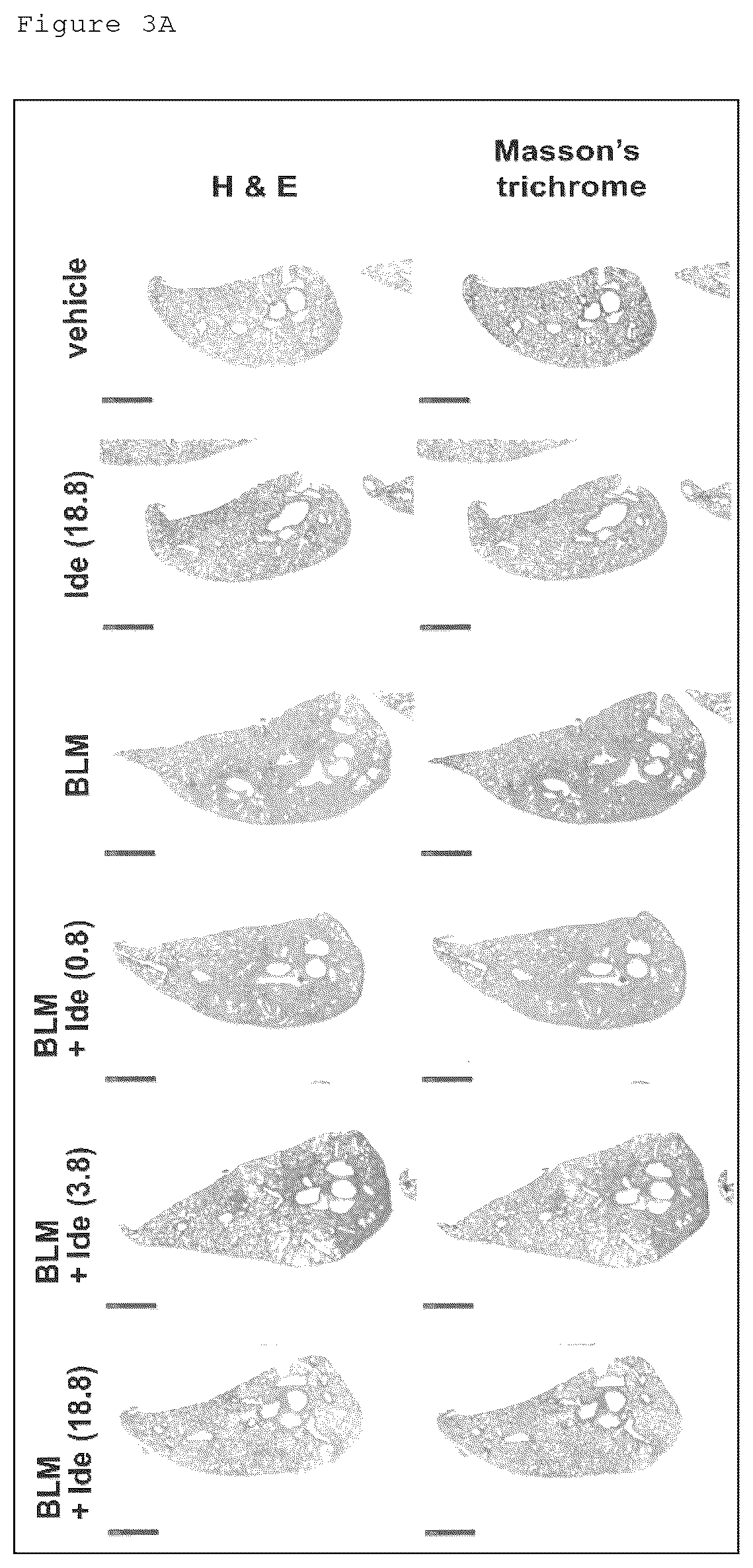 Patent US12098129 Figure 4 – Pharmaceutical composition for treating fibrosis
