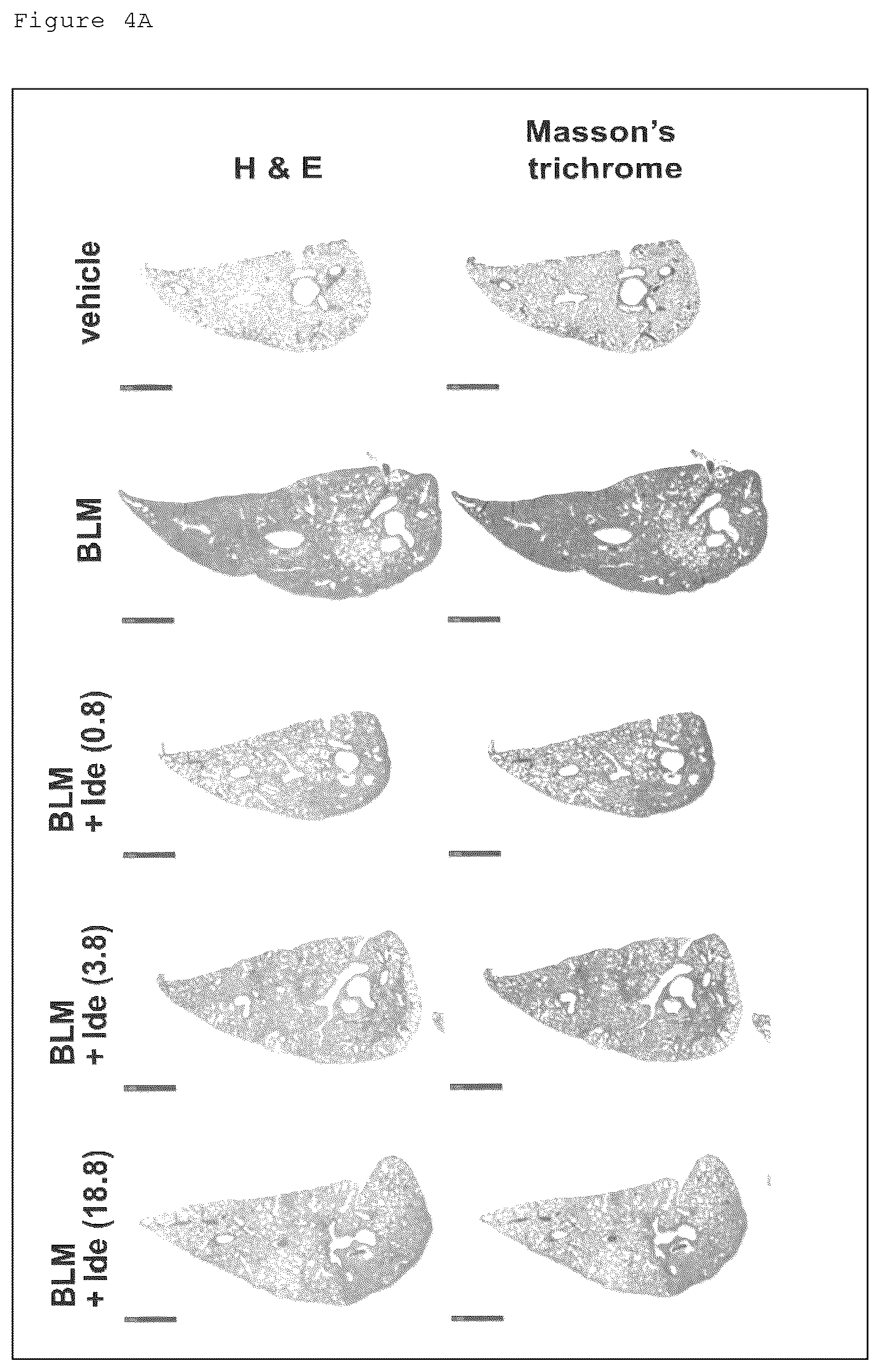 Patent US12098129 Figure 7 – Pharmaceutical composition for treating fibrosis