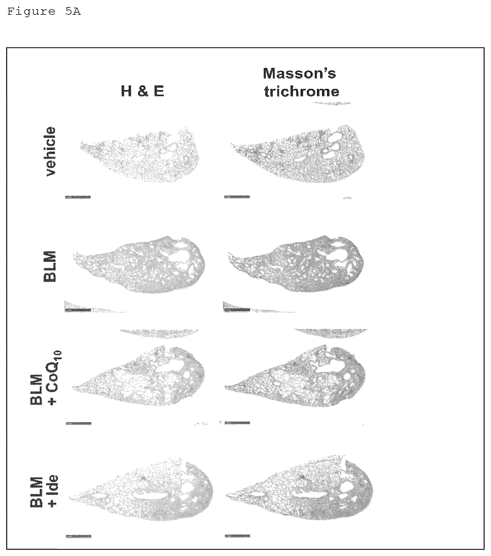 Patent US12098129 Figure 10 – Pharmaceutical composition for treating fibrosis