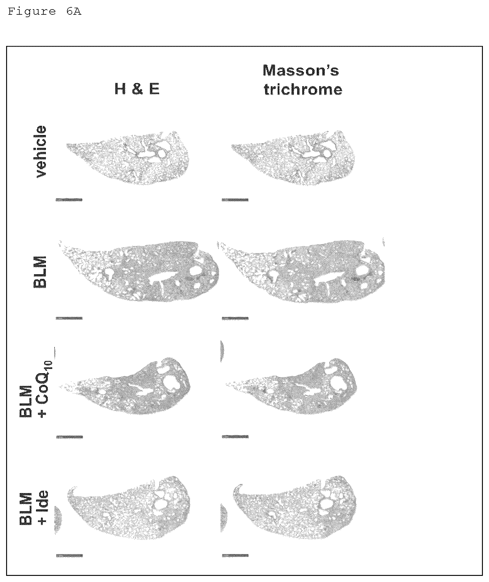 Patent US12098129 Figure 12 – Pharmaceutical composition for treating fibrosis