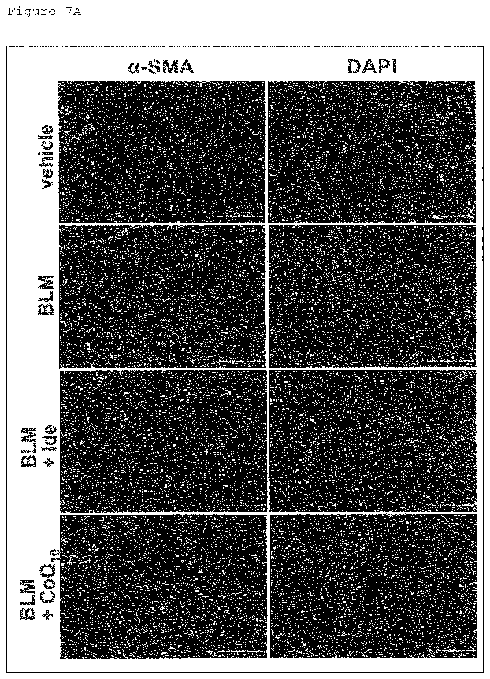 Patent US12098129 Figure 14 – Pharmaceutical composition for treating fibrosis