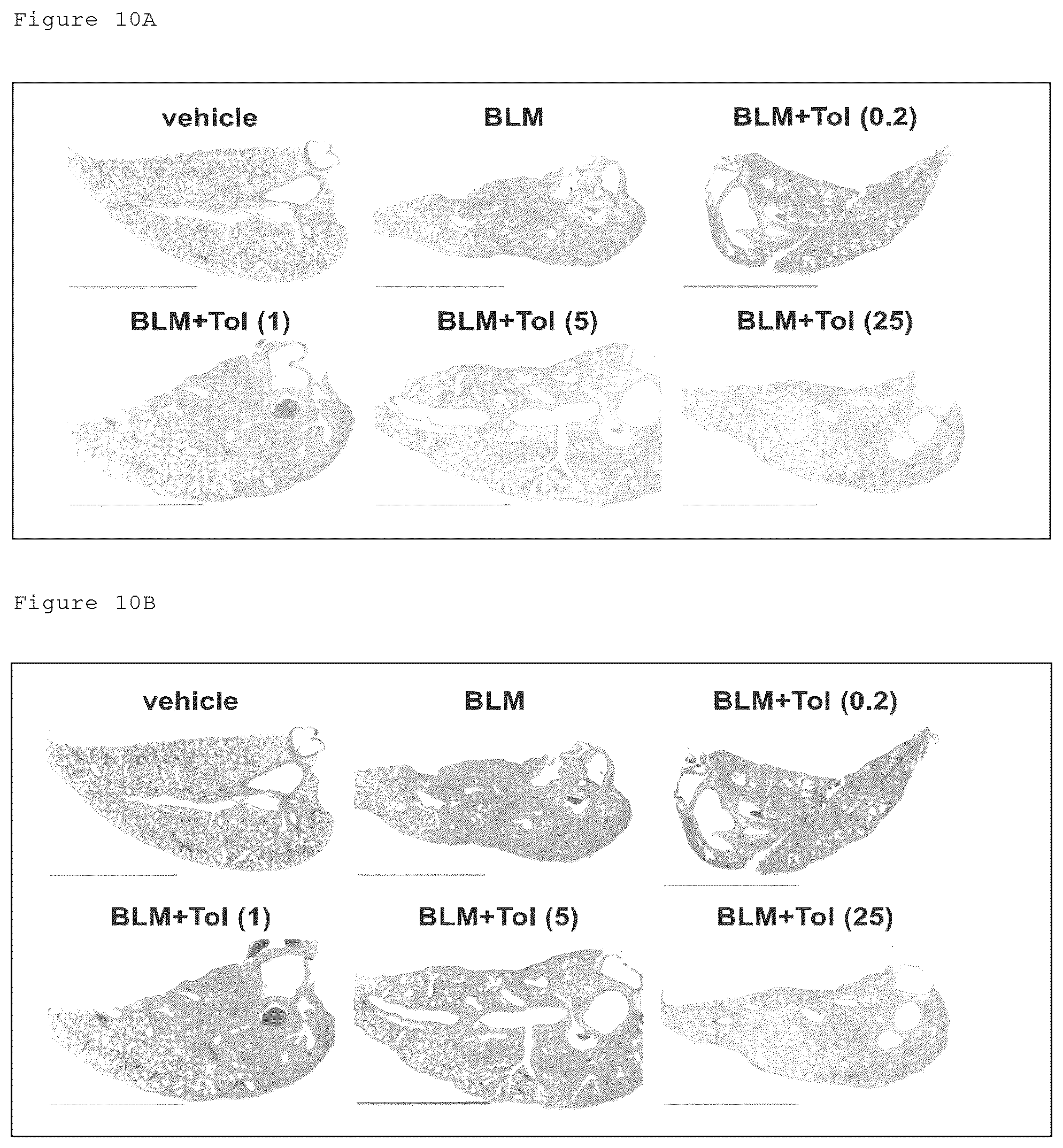 Patent US12098129 Figure 18 – Pharmaceutical composition for treating fibrosis