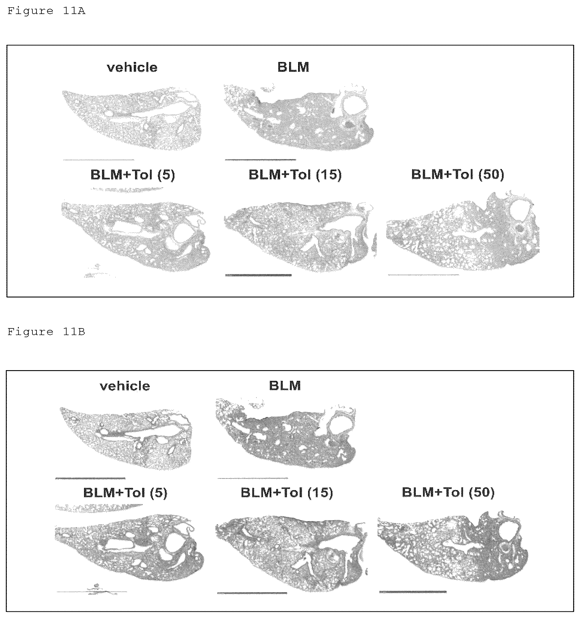 Patent US12098129 Figure 20 – Pharmaceutical composition for treating fibrosis
