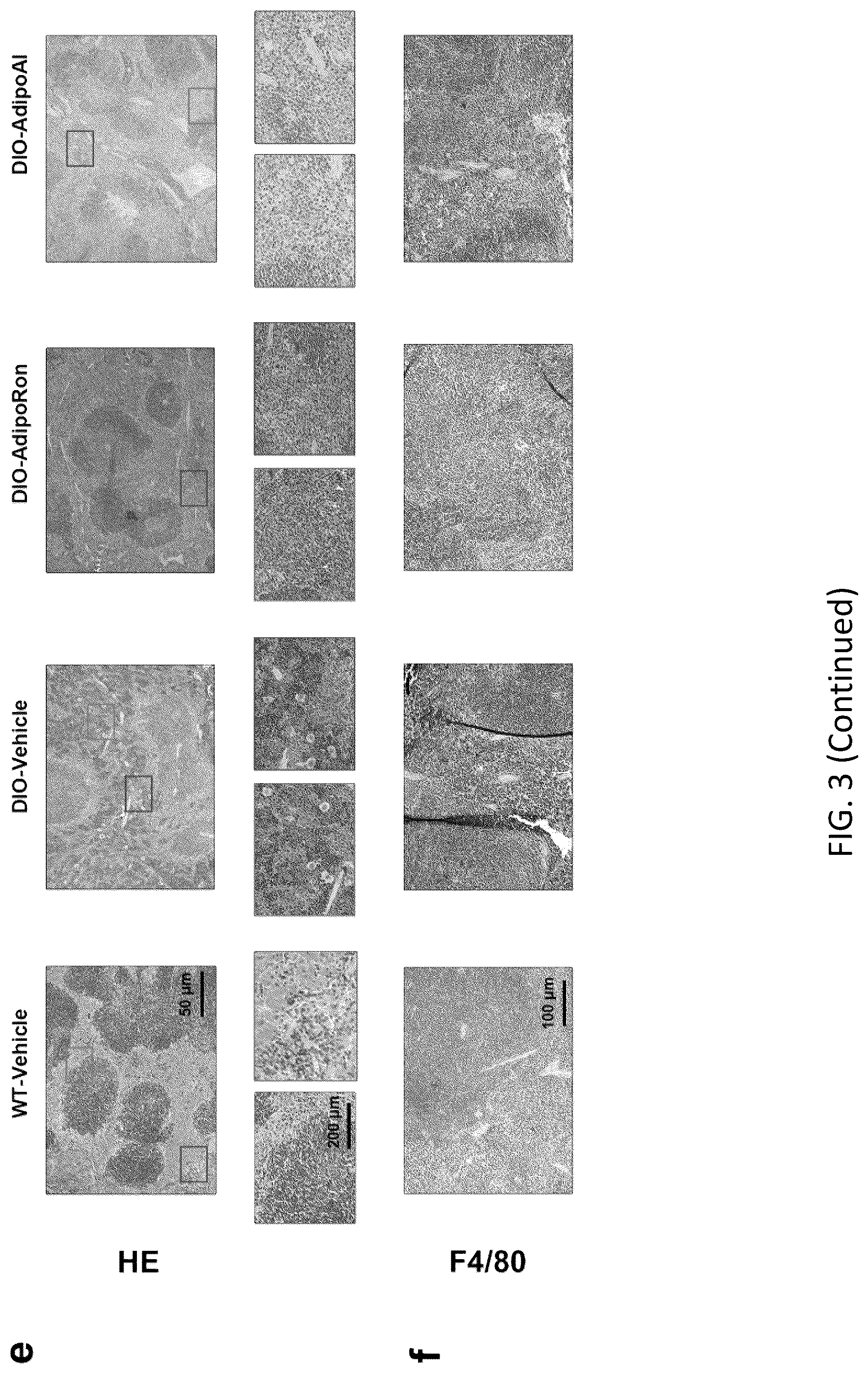 Patent US12098131 Figure 17 – Using adiponectin receptor agonists to treat inflammation and bone diseases in diabetes
