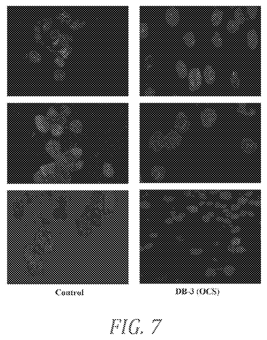Patent US12098138 Figure 20 – Substituted pyridinyl azetidinone derivatives for use in treating cancer and other diseases