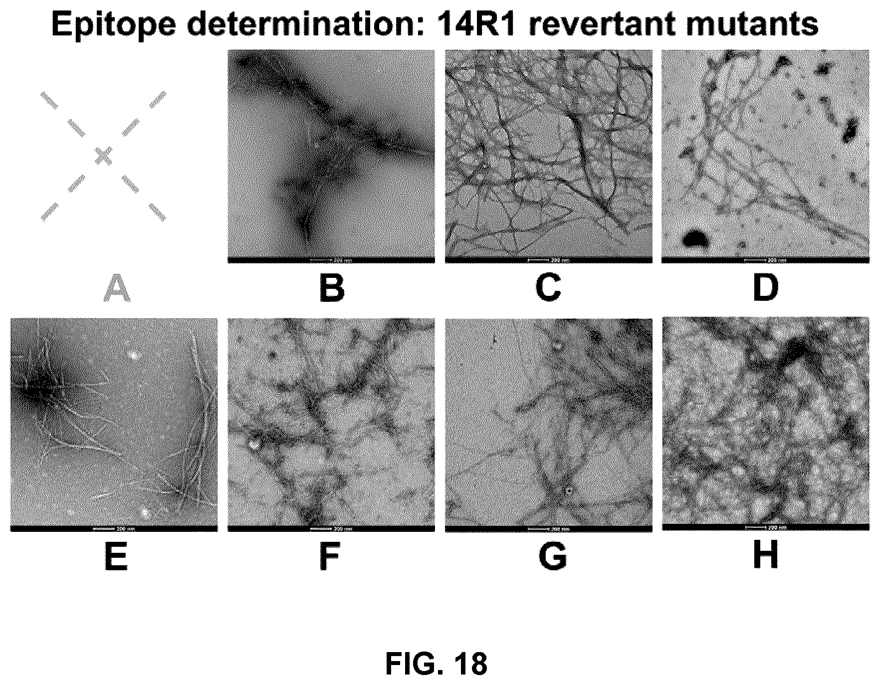 Patent US12098173 Figure 18 – Innocuous, structured scaffolds for structure-based amyloid disease vaccines and antigens
