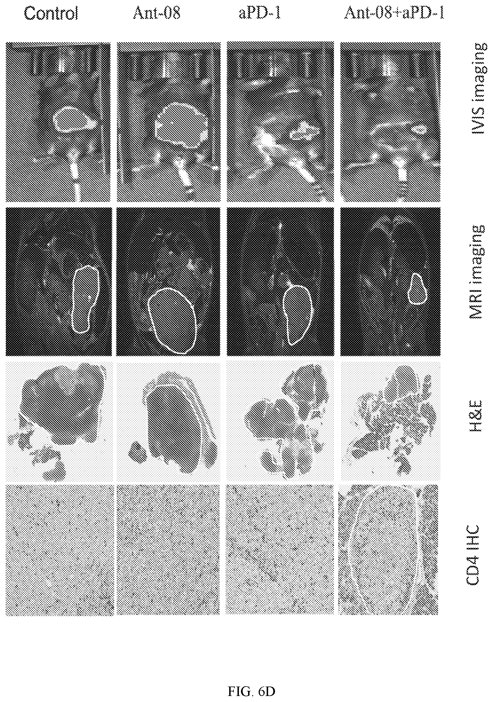 Patent US12098180 Figure 5 – Compositions and uses of vasoactive intestinal peptide (VIP) antagonists