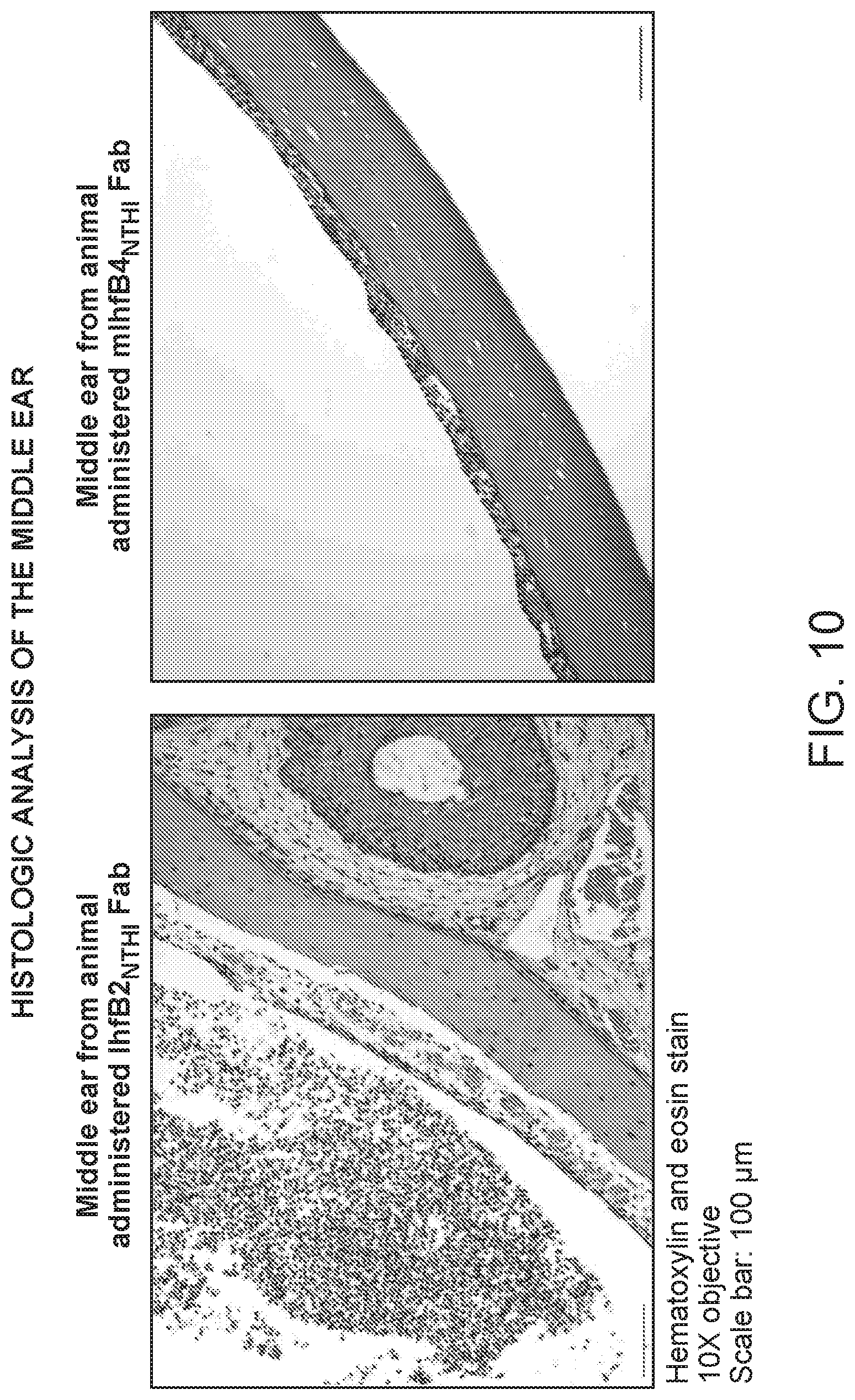 Patent US12098188 Figure 12 – Antibody fragments for the treatment of biofilm-related disorders