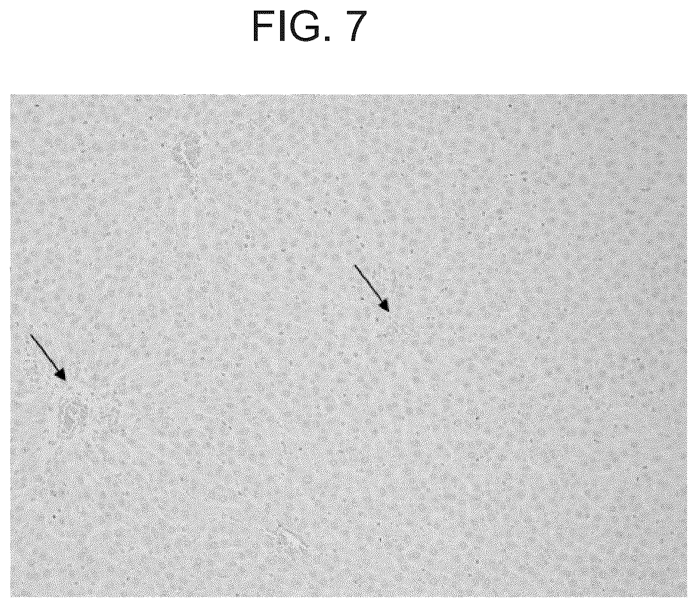Patent US12098189 Figure 7 – Composition and method for the diagnosis and treatment of iron-related disorders