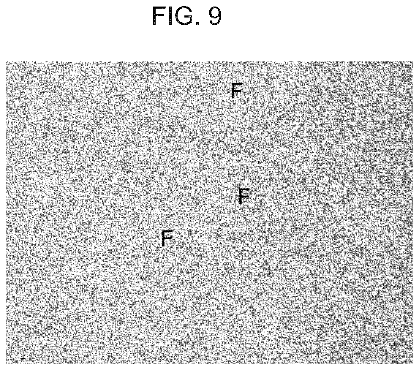 Patent US12098189 Figure 9 – Composition and method for the diagnosis and treatment of iron-related disorders