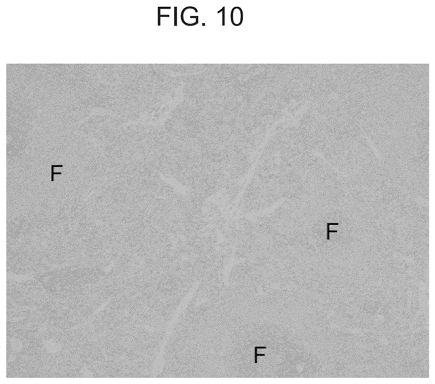 Patent US12098189 Figure 10 – Composition and method for the diagnosis and treatment of iron-related disorders