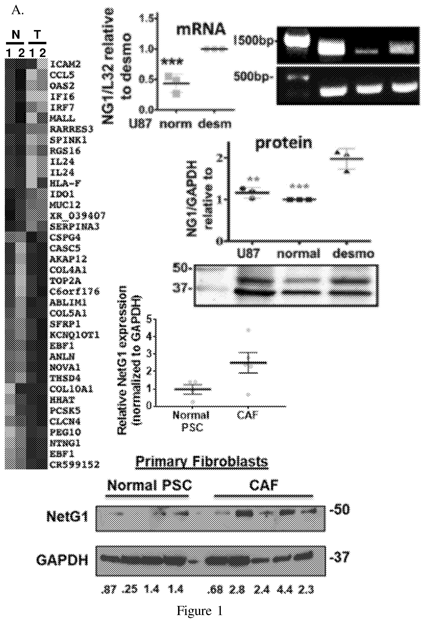 Patent US12098193 Figure 1 – Netrin G1 as a biomarker for enhancing tumor treatment efficacy
