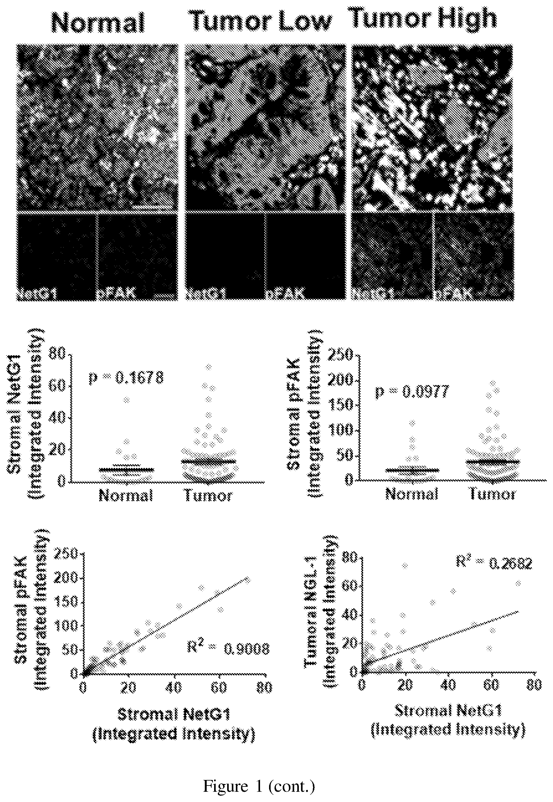 Patent US12098193 Figure 3 – Netrin G1 as a biomarker for enhancing tumor treatment efficacy