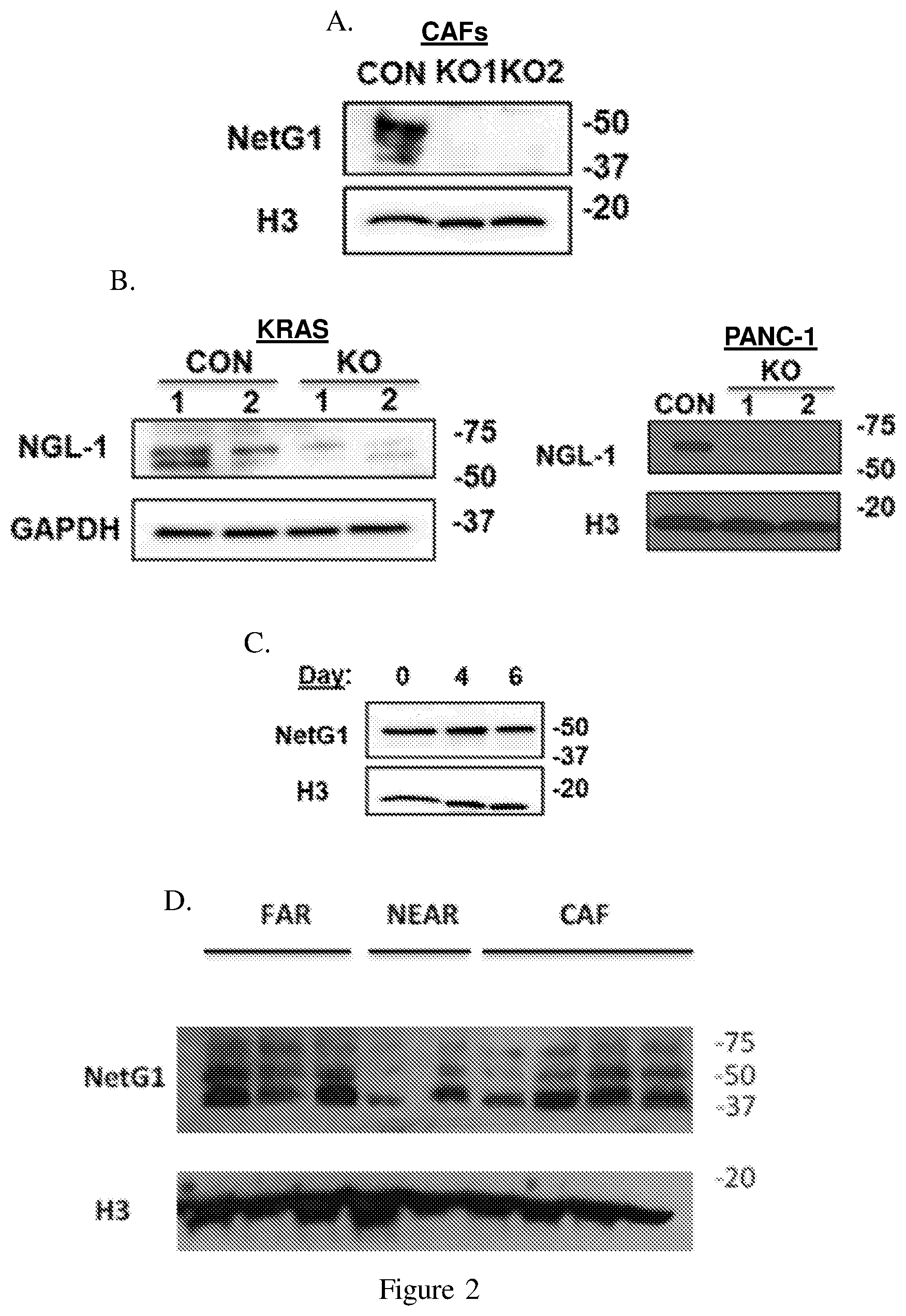 Patent US12098193 Figure 4 – Netrin G1 as a biomarker for enhancing tumor treatment efficacy