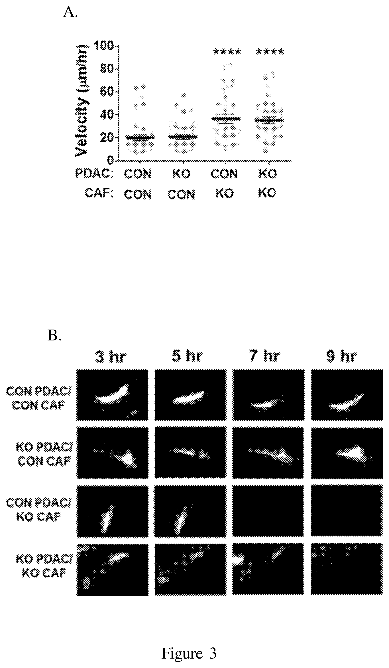 Patent US12098193 Figure 5 – Netrin G1 as a biomarker for enhancing tumor treatment efficacy