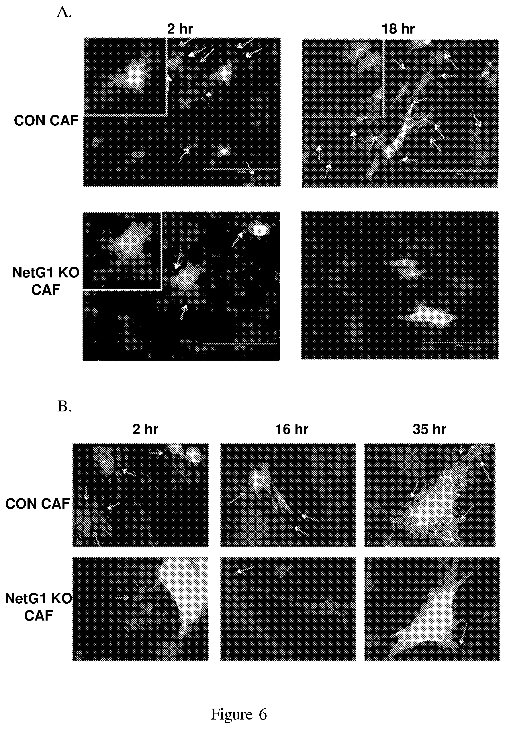 Patent US12098193 Figure 11 – Netrin G1 as a biomarker for enhancing tumor treatment efficacy