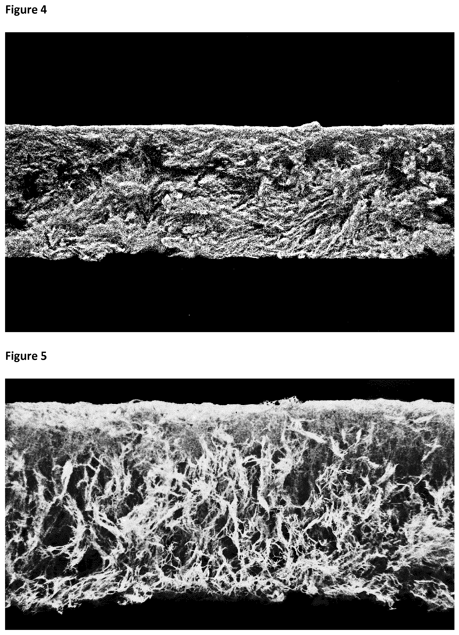 Patent US12098259 Figure 3 – Porous material of cellulose fibres and gluten