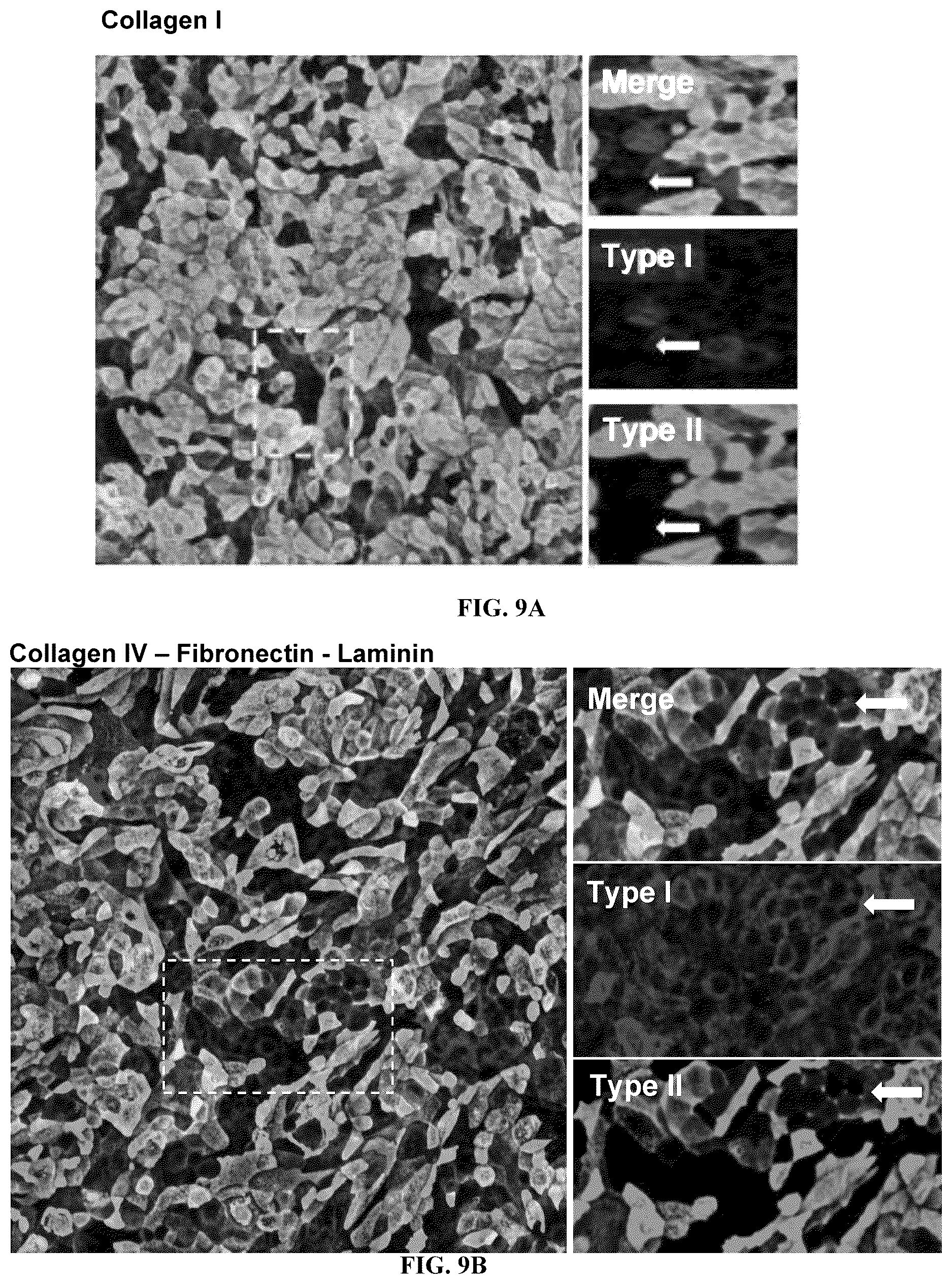Patent US12098352 Figure 17 – Stem cell-based lung-on-chip models