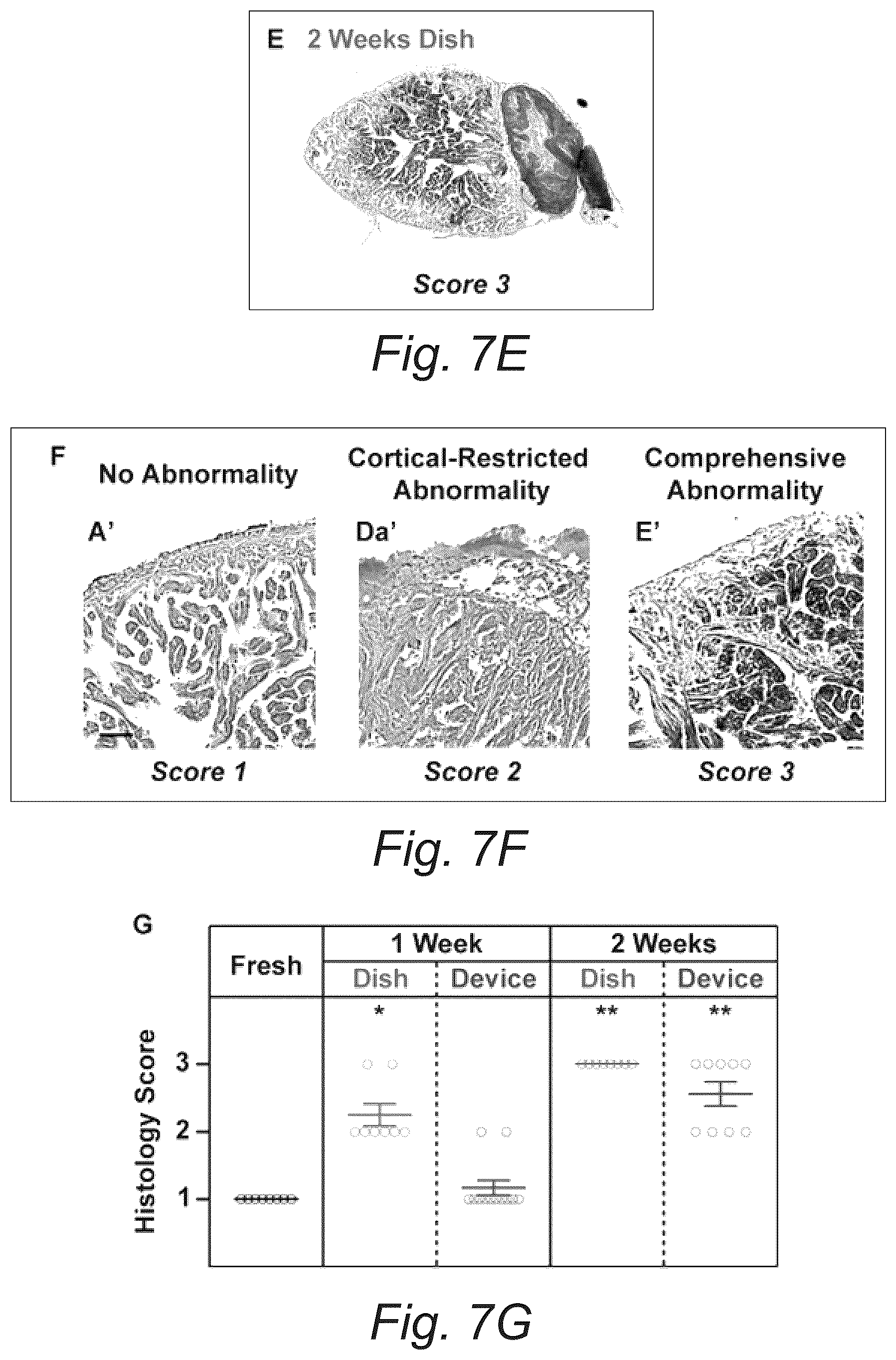 Patent US12098353 Figure 11 – Fluidic device for long-term explant culture and imaging