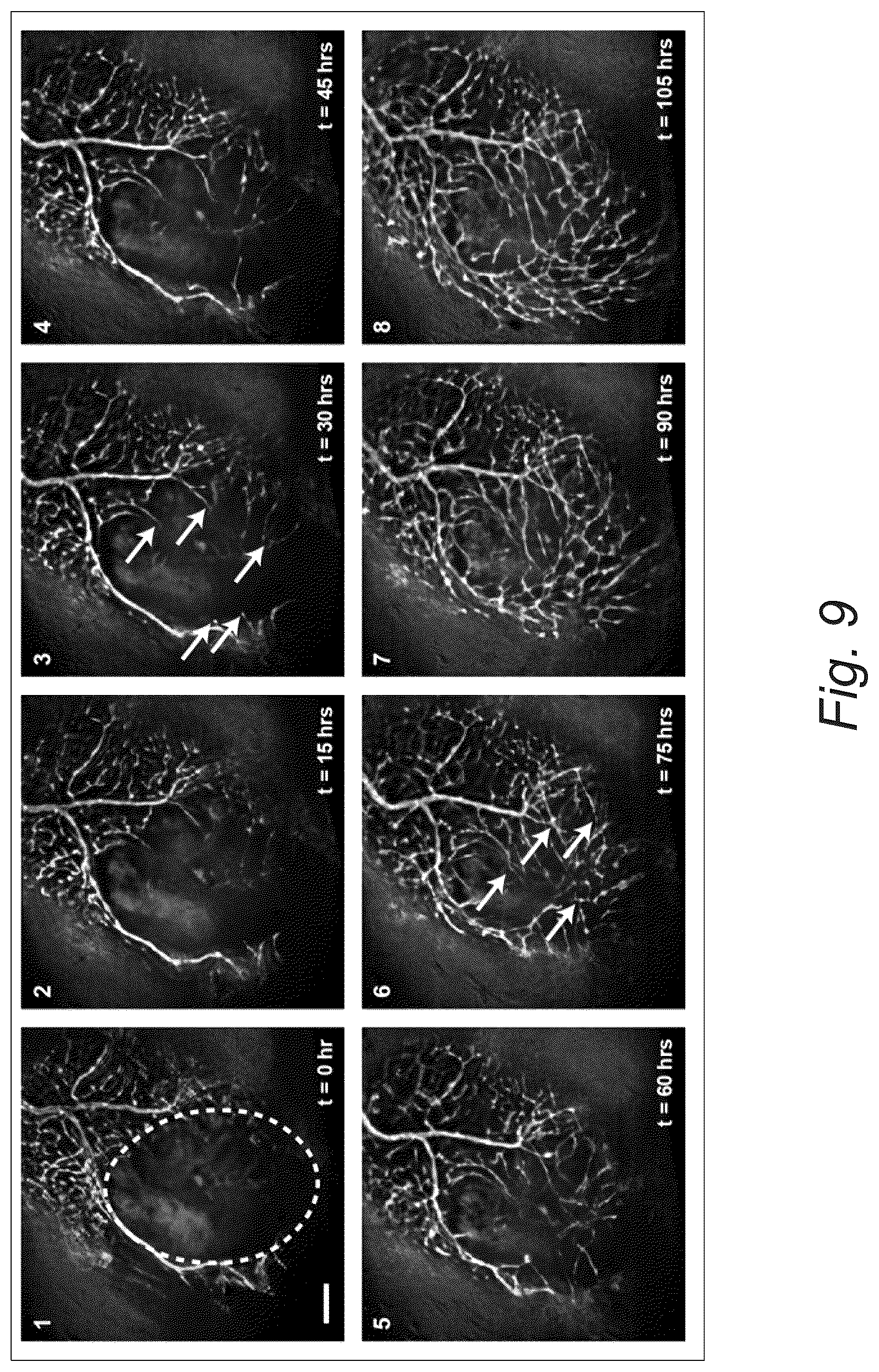 Patent US12098353 Figure 14 – Fluidic device for long-term explant culture and imaging