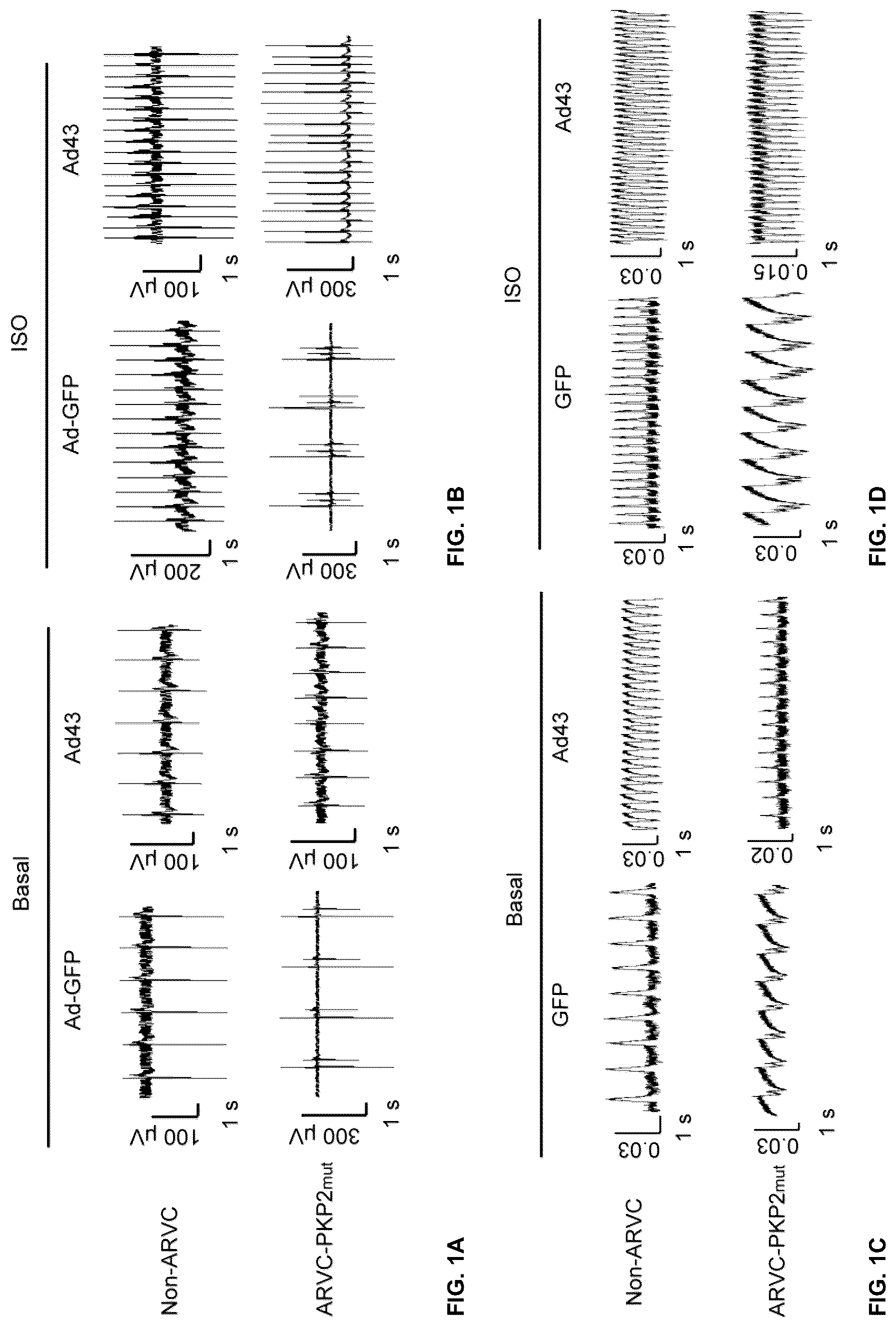 Patent US12098385 Figure 1 – Gene therapy strategy to restore cardiac electrical and structural function in arrhythmogenic right ventricular cardiomyopathy