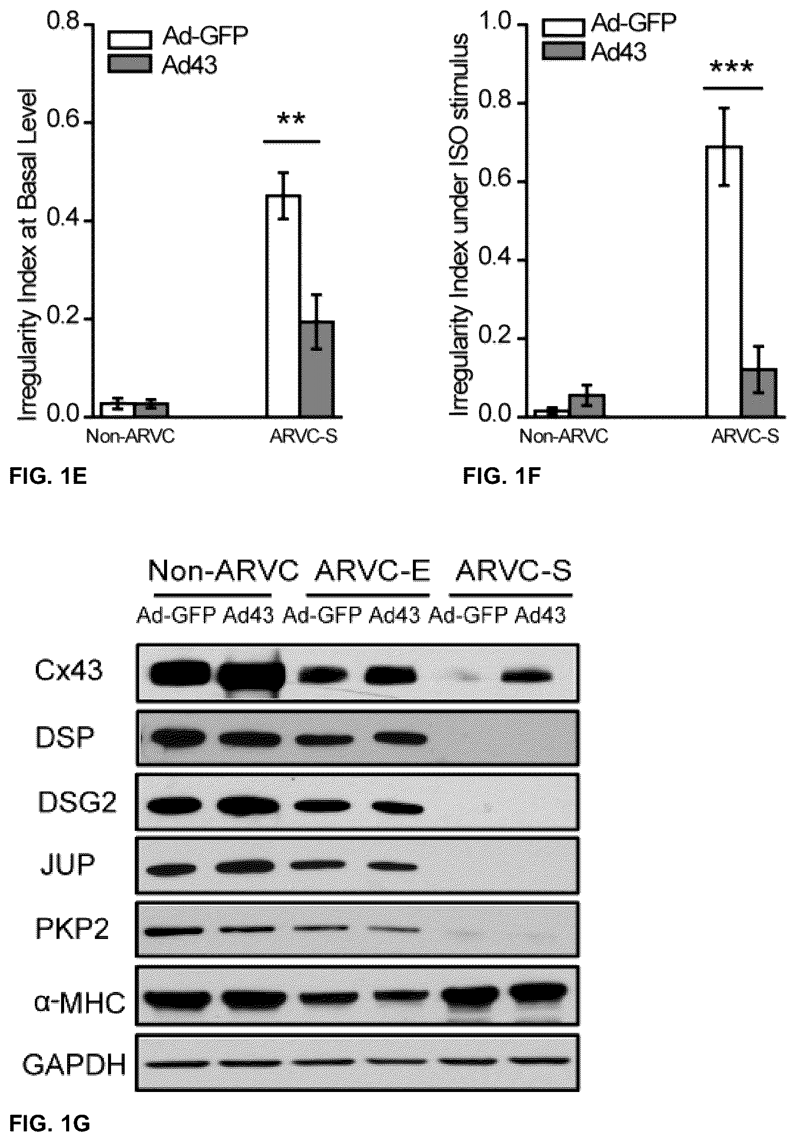 Patent US12098385 Figure 2 – Gene therapy strategy to restore cardiac electrical and structural function in arrhythmogenic right ventricular cardiomyopathy