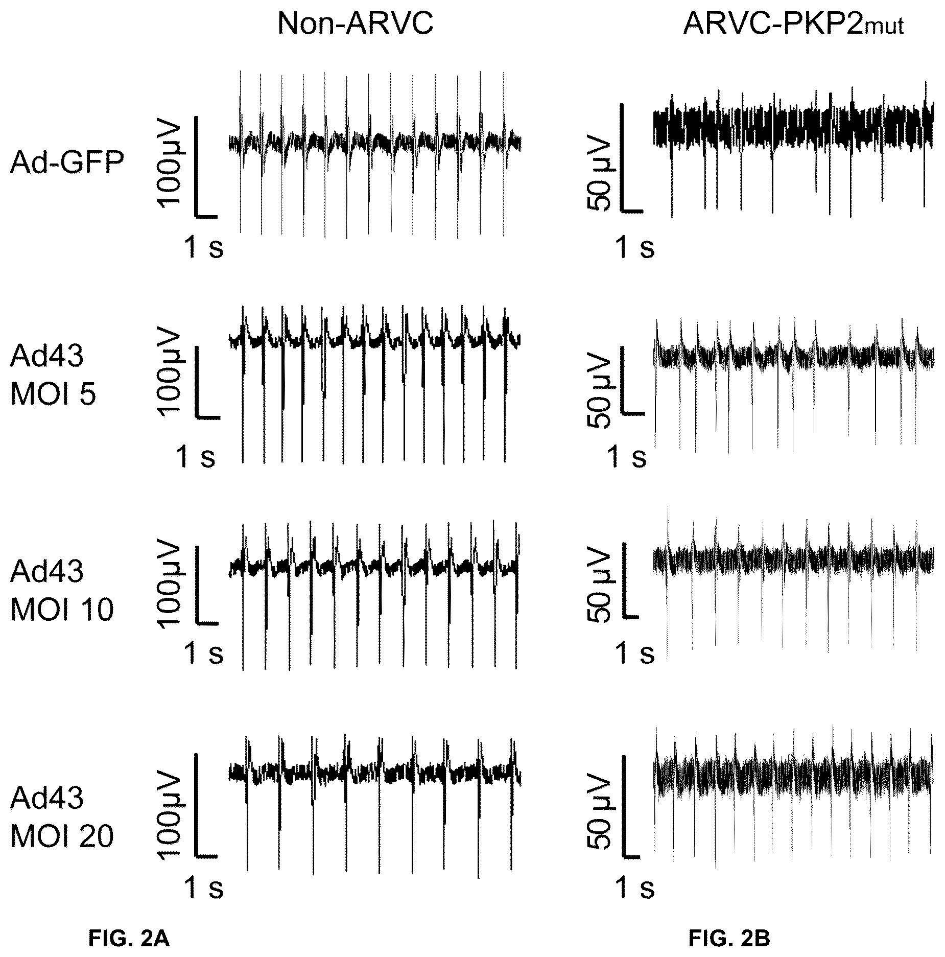Patent US12098385 Figure 3 – Gene therapy strategy to restore cardiac electrical and structural function in arrhythmogenic right ventricular cardiomyopathy