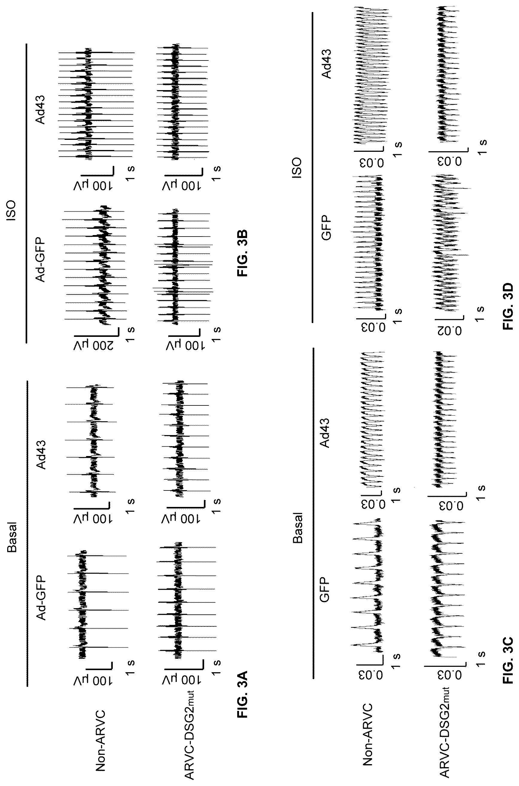 Patent US12098385 Figure 4 – Gene therapy strategy to restore cardiac electrical and structural function in arrhythmogenic right ventricular cardiomyopathy