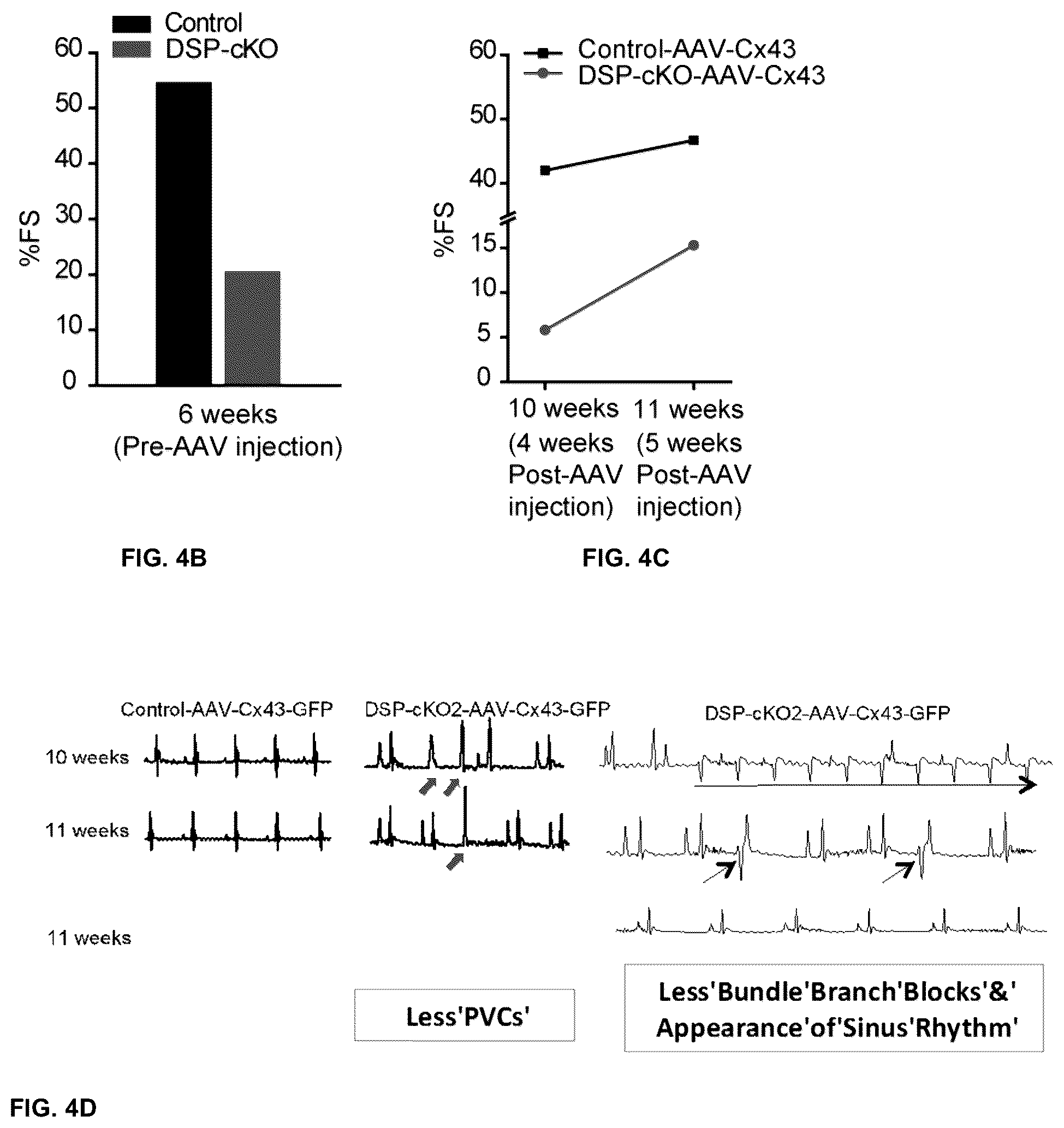 Patent US12098385 Figure 7 – Gene therapy strategy to restore cardiac electrical and structural function in arrhythmogenic right ventricular cardiomyopathy