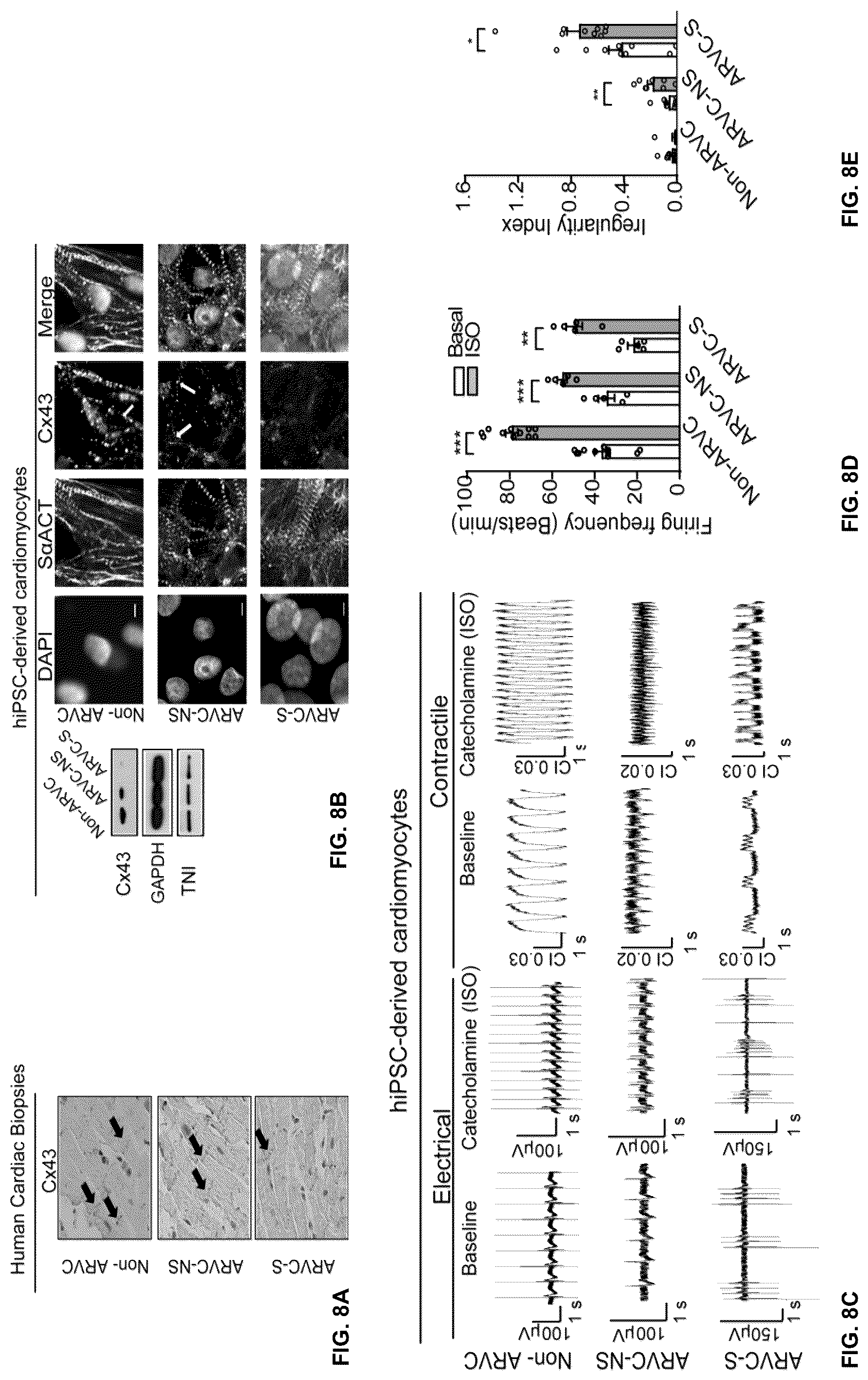Patent US12098385 Figure 13 – Gene therapy strategy to restore cardiac electrical and structural function in arrhythmogenic right ventricular cardiomyopathy