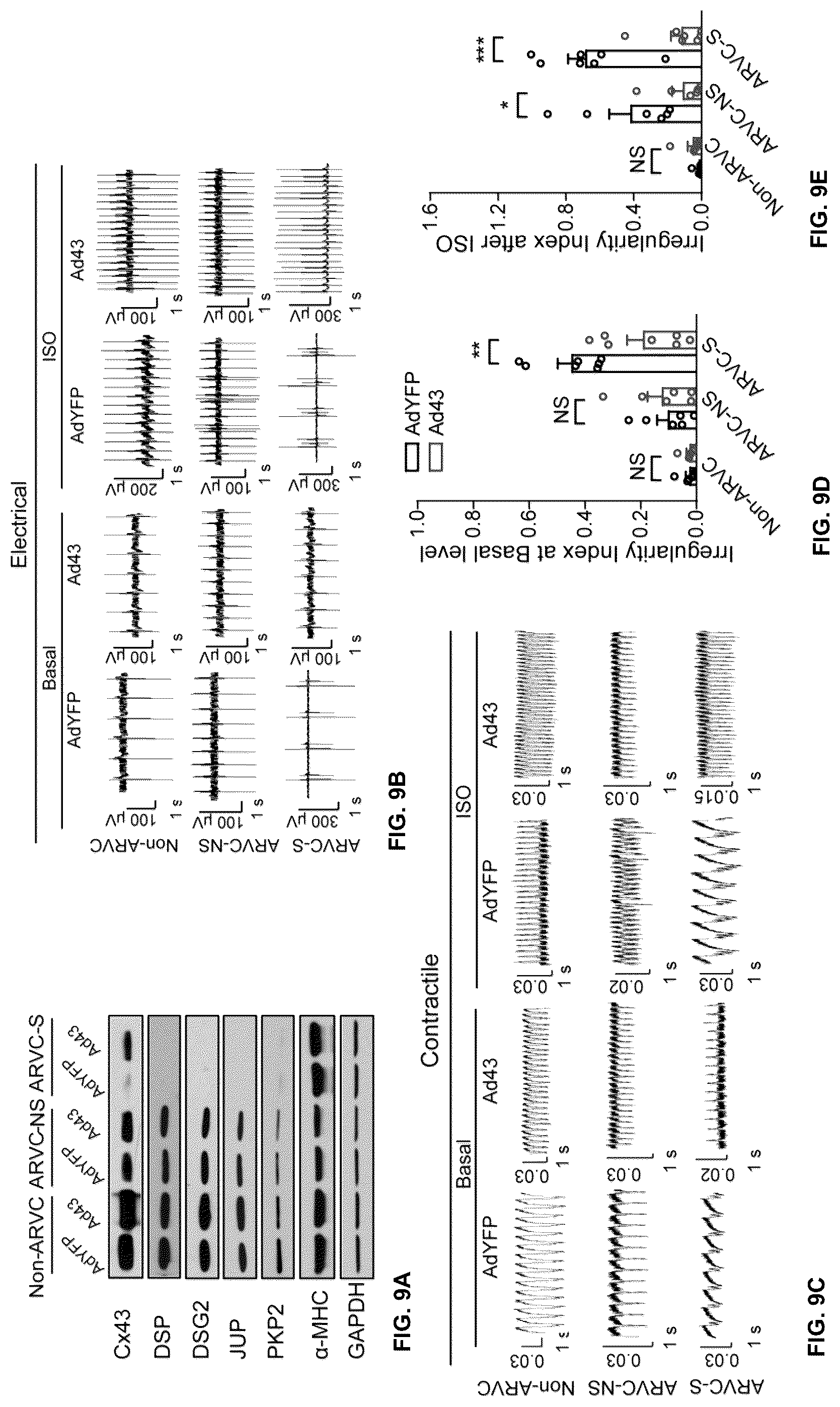 Patent US12098385 Figure 14 – Gene therapy strategy to restore cardiac electrical and structural function in arrhythmogenic right ventricular cardiomyopathy