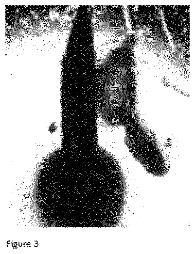 Patent US12098386 Figure 3 – Use of germ cells for preparing a micro hair follicle