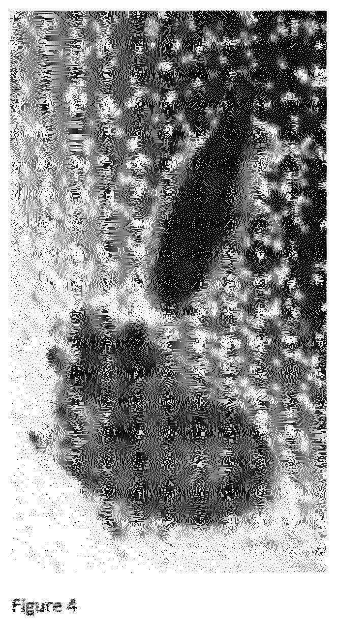 Patent US12098386 Figure 4 – Use of germ cells for preparing a micro hair follicle