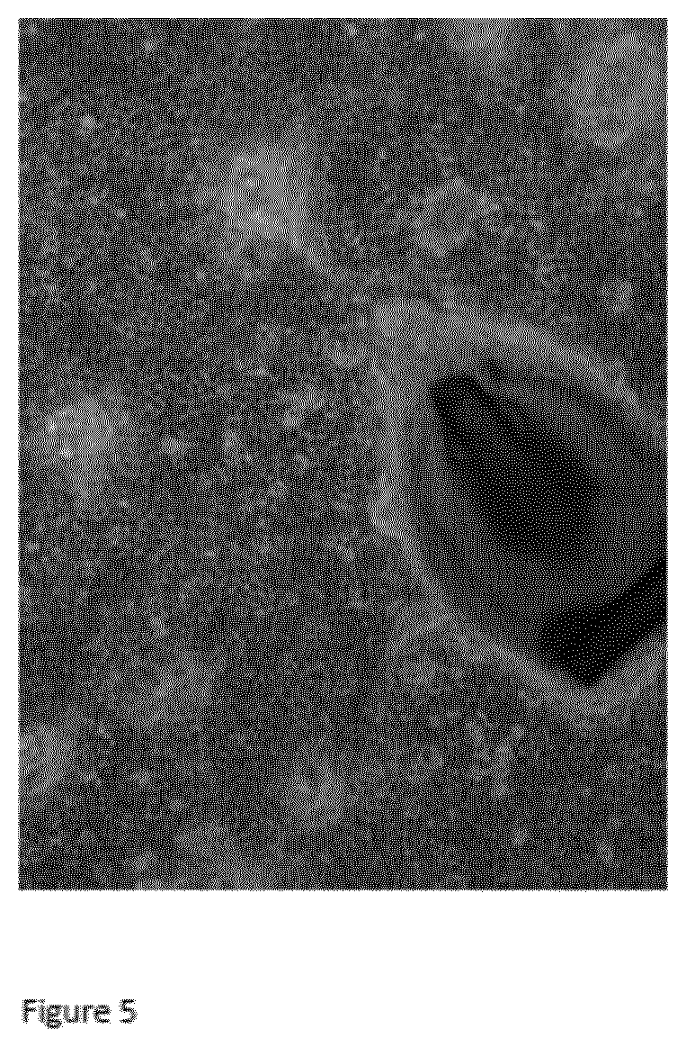 Patent US12098386 Figure 5 – Use of germ cells for preparing a micro hair follicle