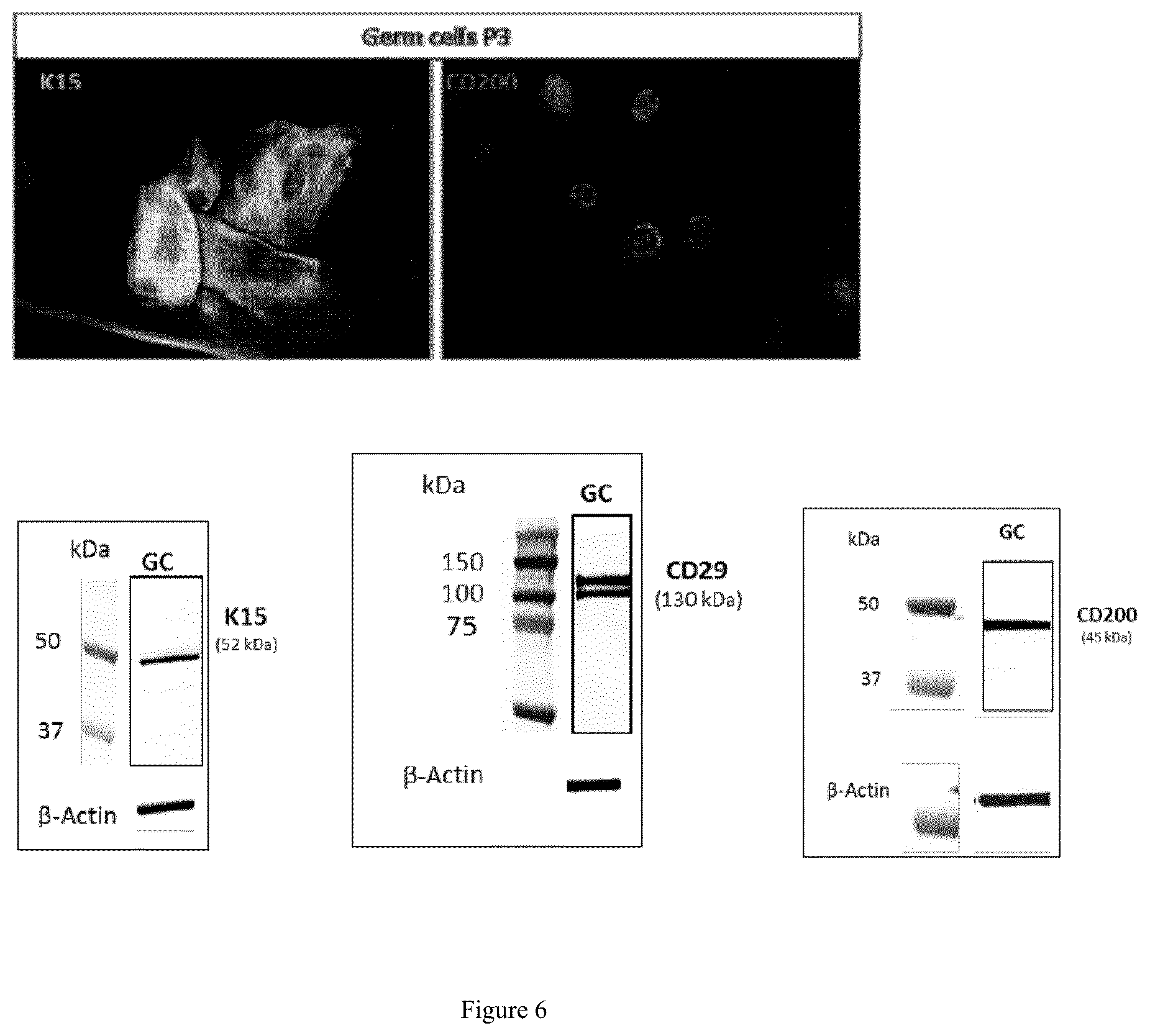 Patent US12098386 Figure 6 – Use of germ cells for preparing a micro hair follicle