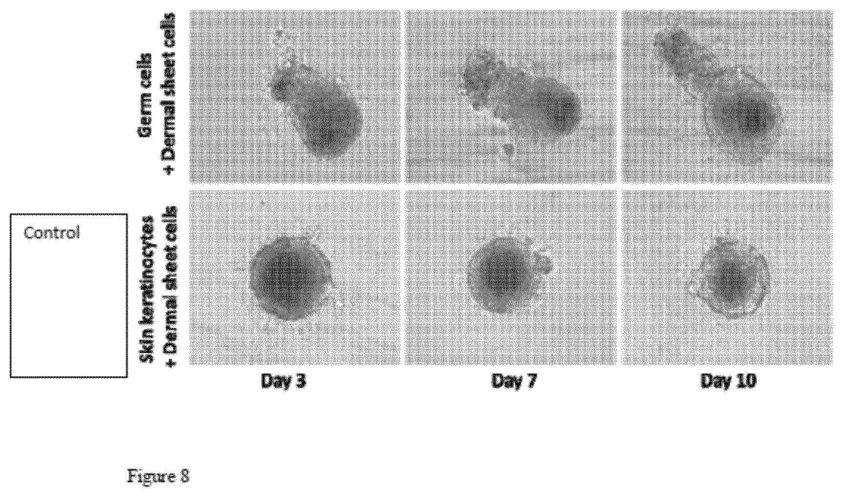 Patent US12098386 Figure 8 – Use of germ cells for preparing a micro hair follicle