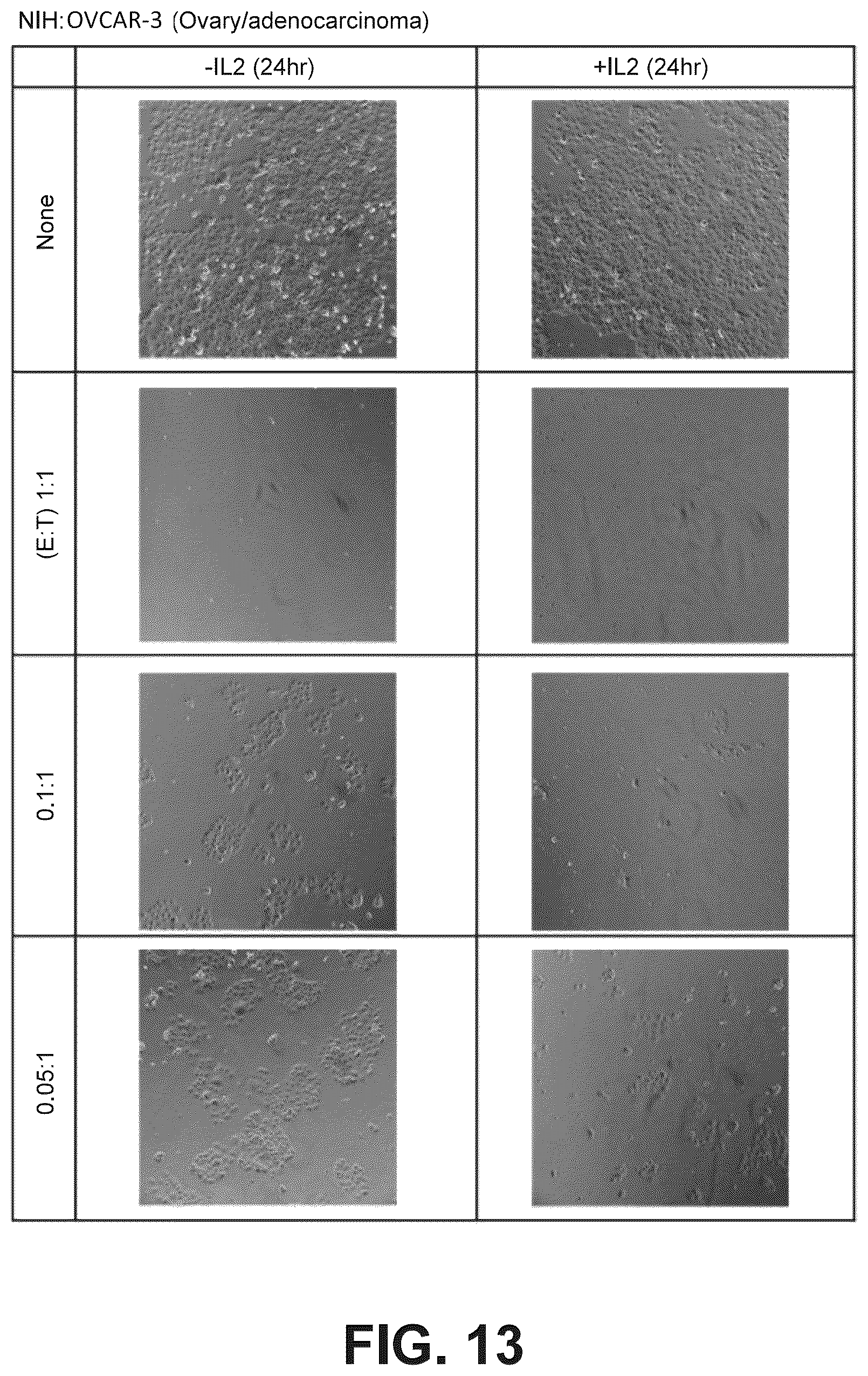 Patent US12098388 Figure 16 – Method of producing natural killer cells and composition for treating cancer
