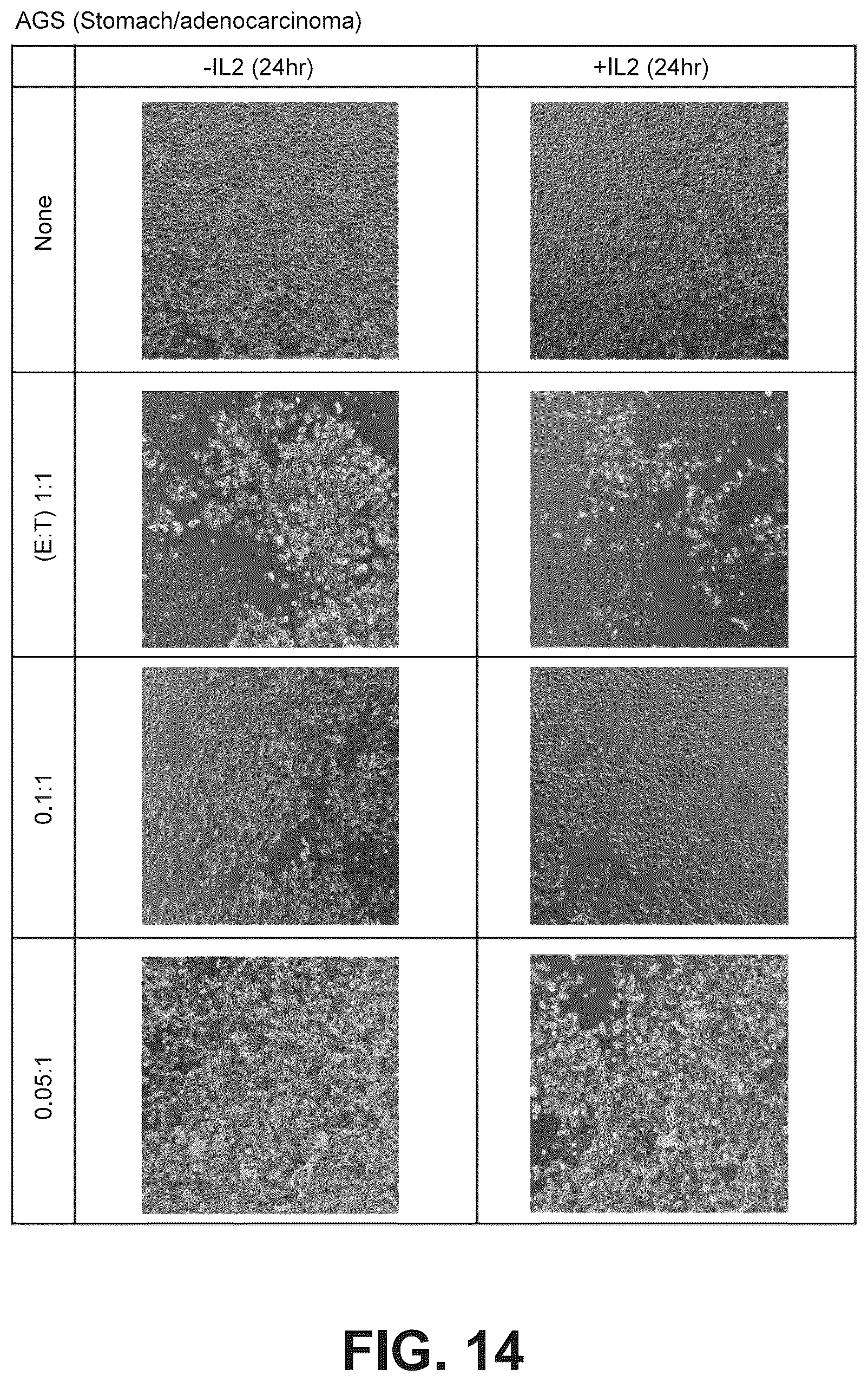 Patent US12098388 Figure 17 – Method of producing natural killer cells and composition for treating cancer