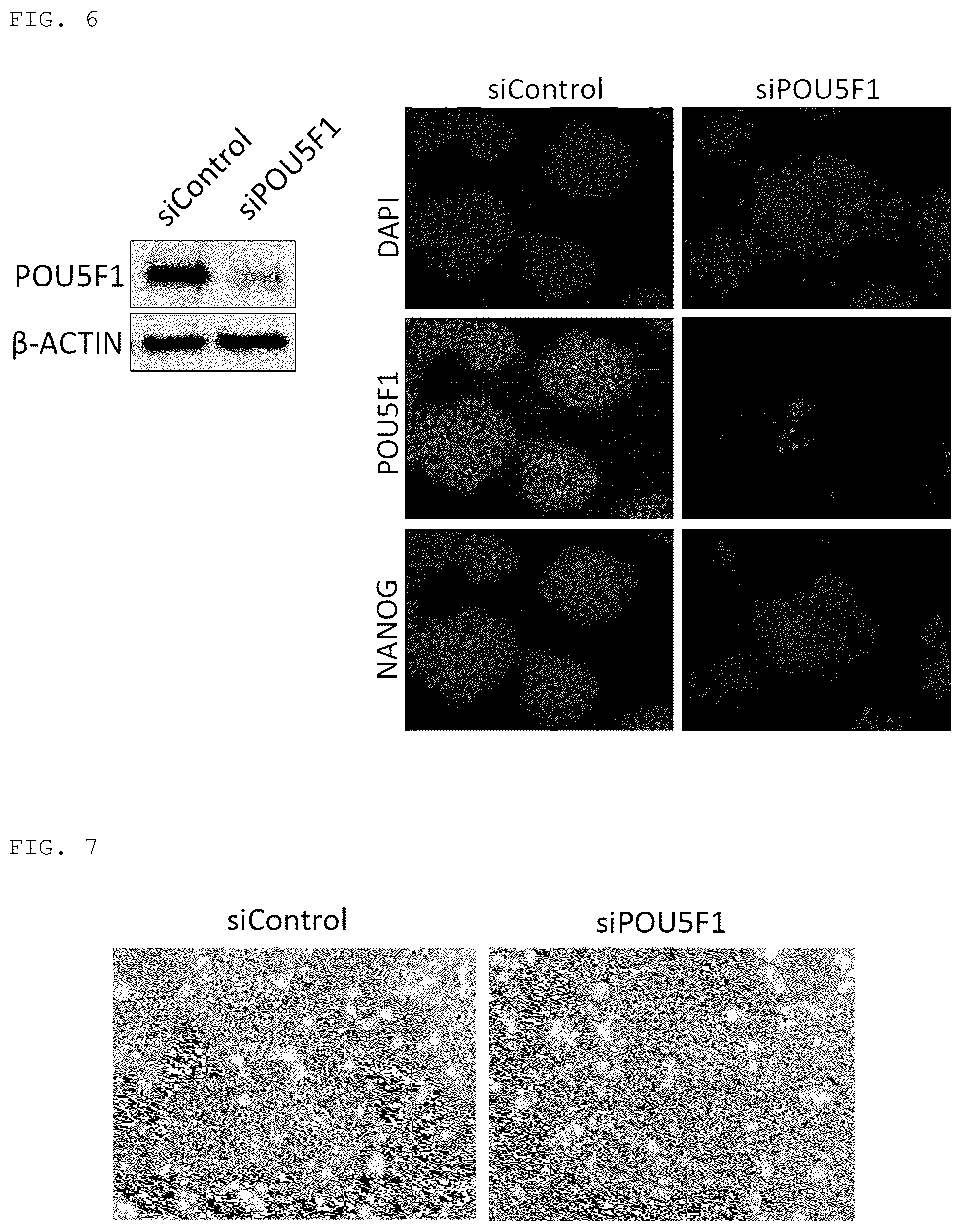 Patent US12098389 Figure 5 – Method for promoting differentiation of pluripotent stem cells by reducing undifferentiated state thereof