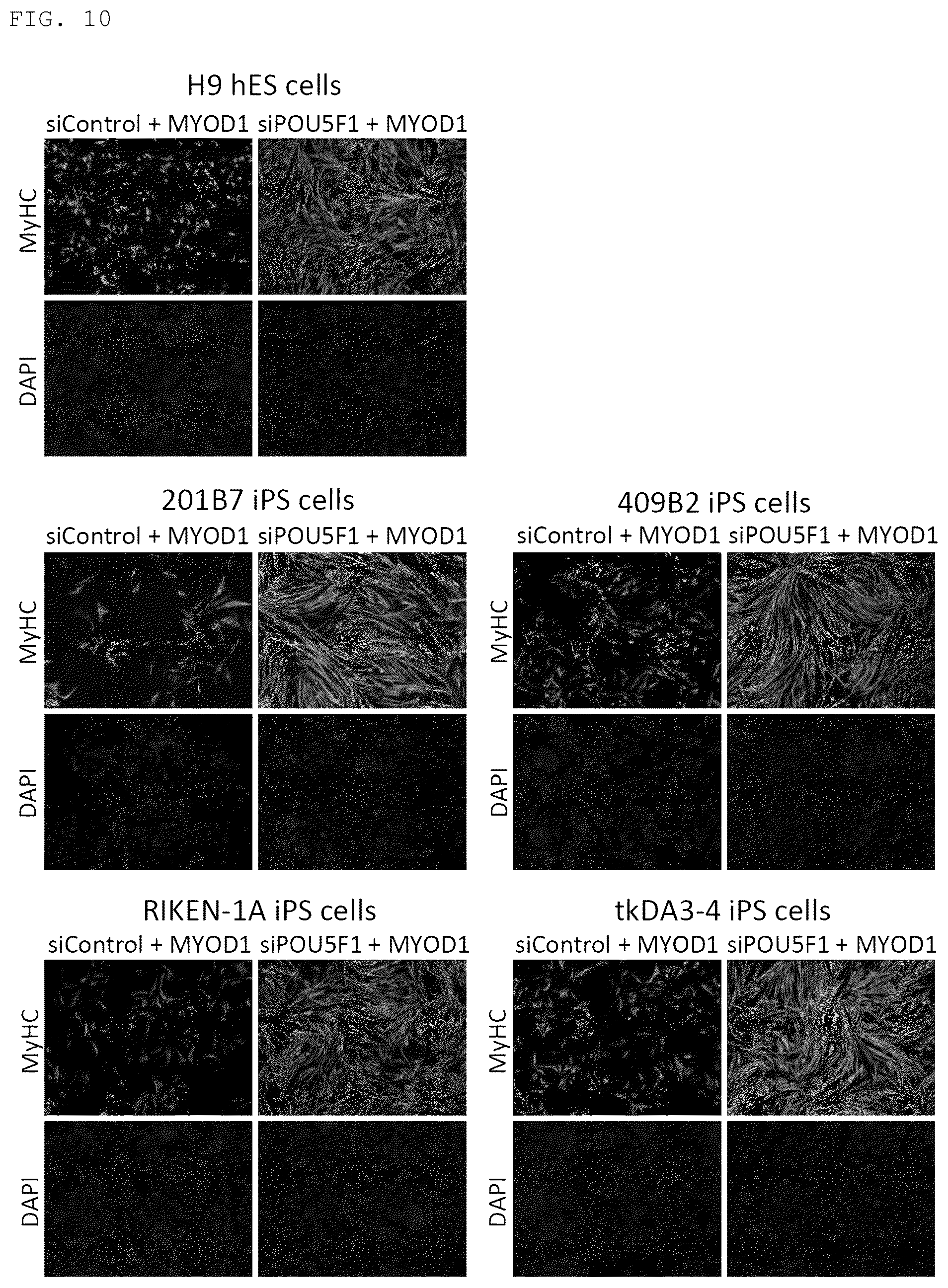 Patent US12098389 Figure 7 – Method for promoting differentiation of pluripotent stem cells by reducing undifferentiated state thereof