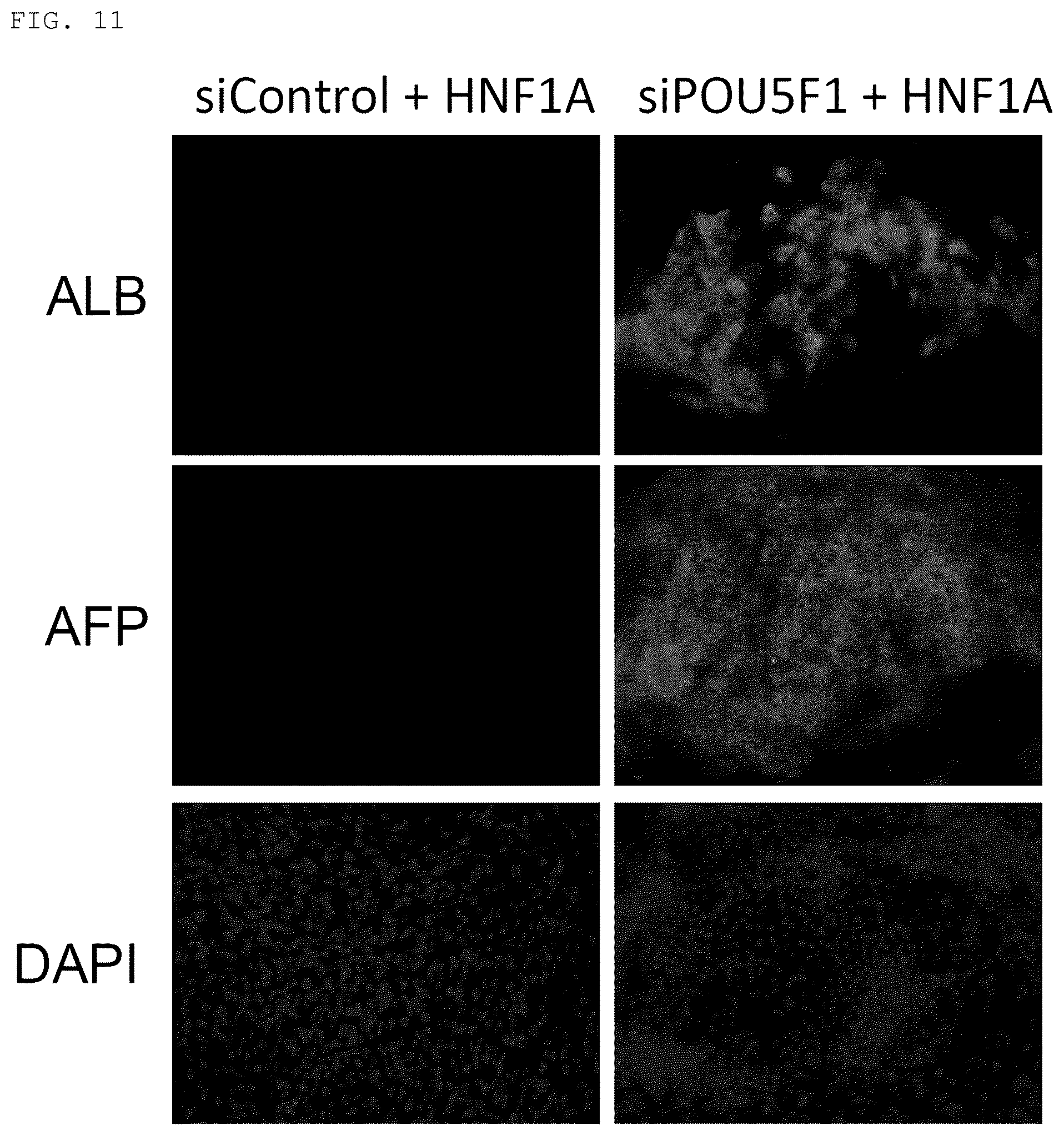 Patent US12098389 Figure 8 – Method for promoting differentiation of pluripotent stem cells by reducing undifferentiated state thereof