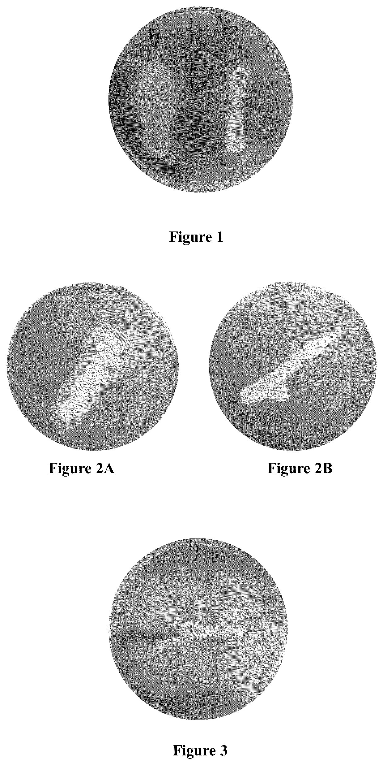 Patent US12098409 Figure 1 – Probiotic bacteria for yeast bioethanol production