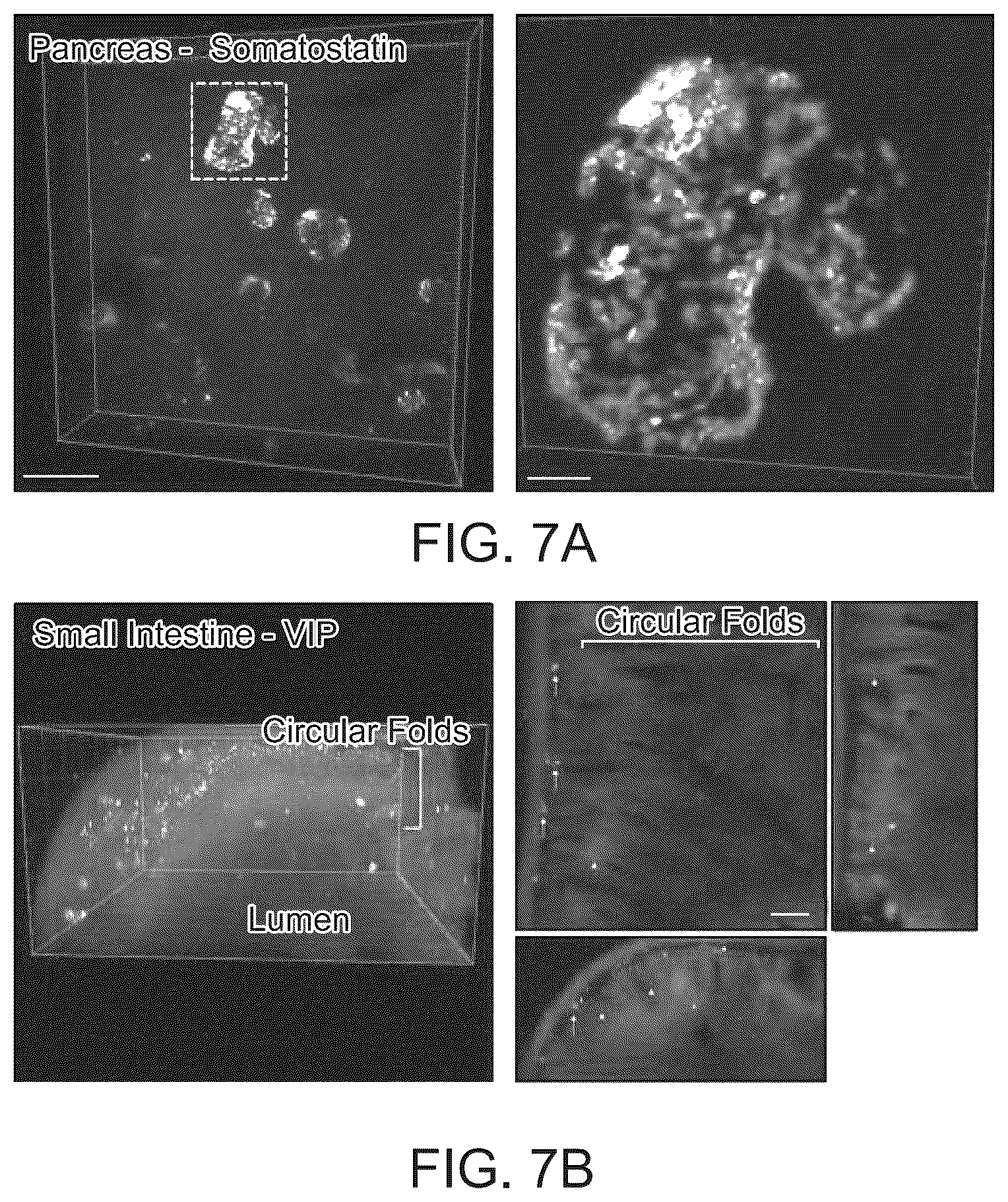 Patent US12098418 Figure 11 – RNA fixation and detection in CLARITY-based hydrogel tissue