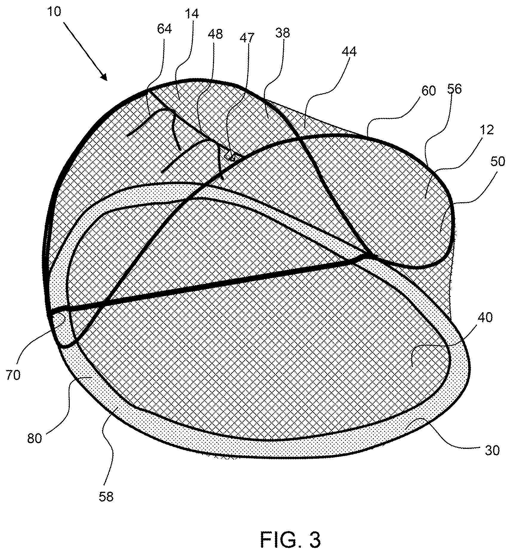 Patent US12098565 Figure 2 – Floating insect canopy