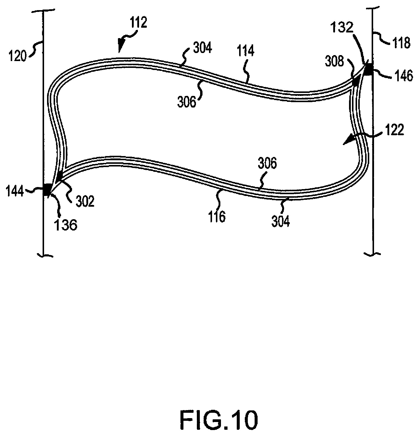Patent US12098594 Figure 11 – Covering for architectural openings with coordinated vane sets