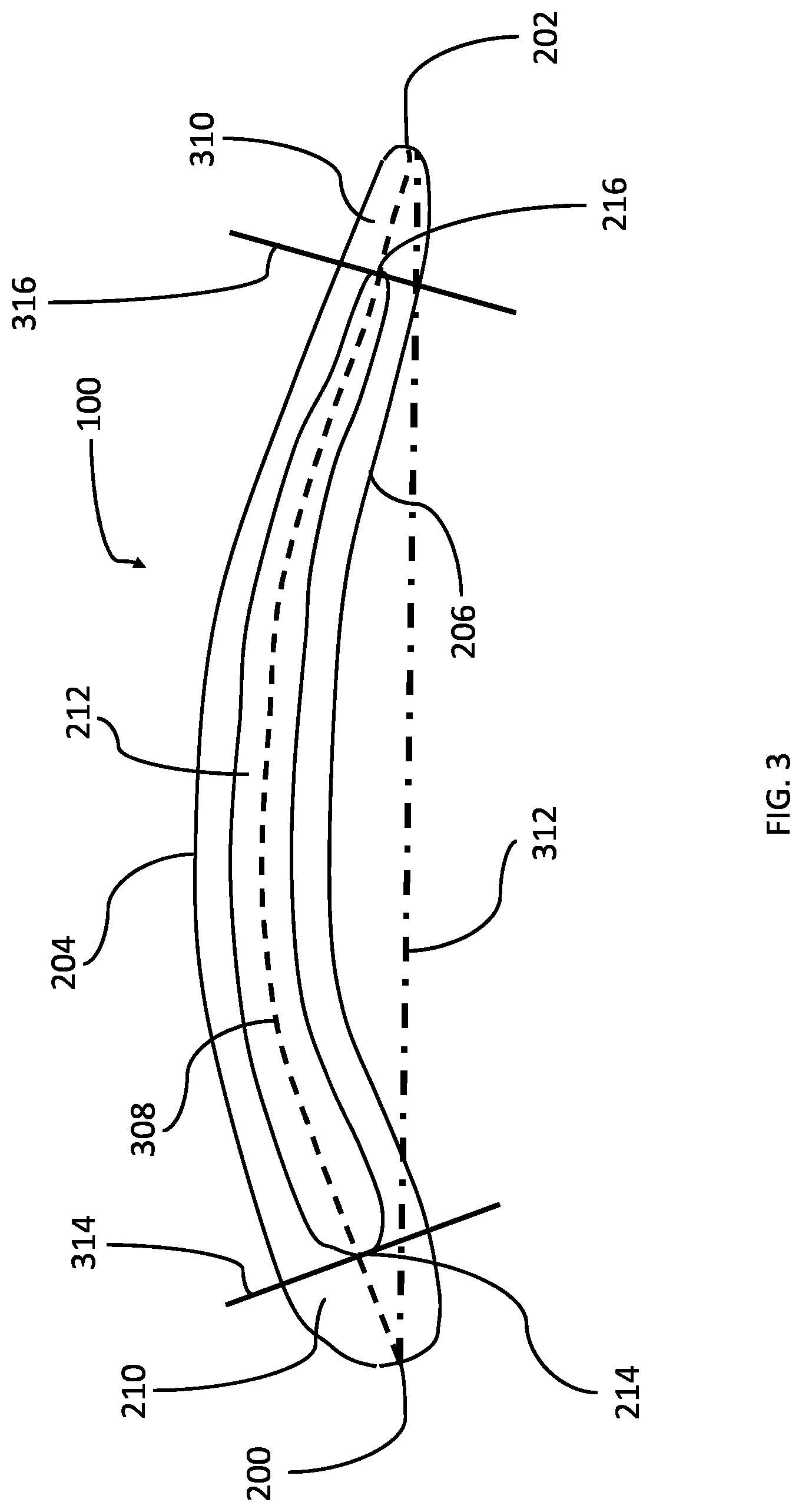 Patent US12098651 Figure 3 – Aerofoil shaping method