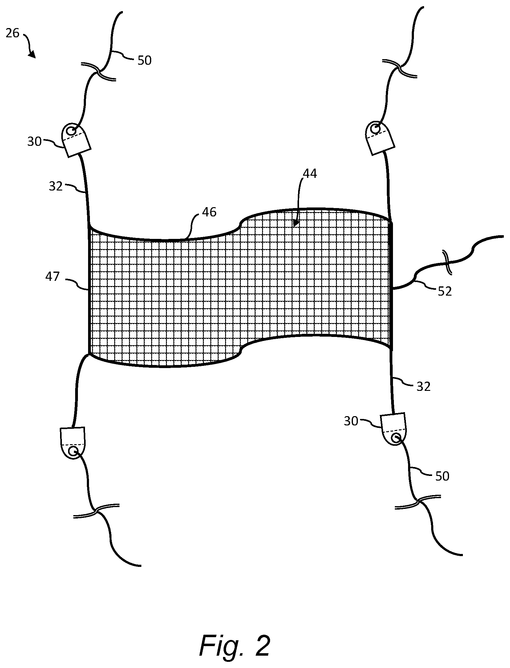 Patent US12098698 Figure 2 – System and method for installation of an open-sleeve add-on device on a wind turbine blade