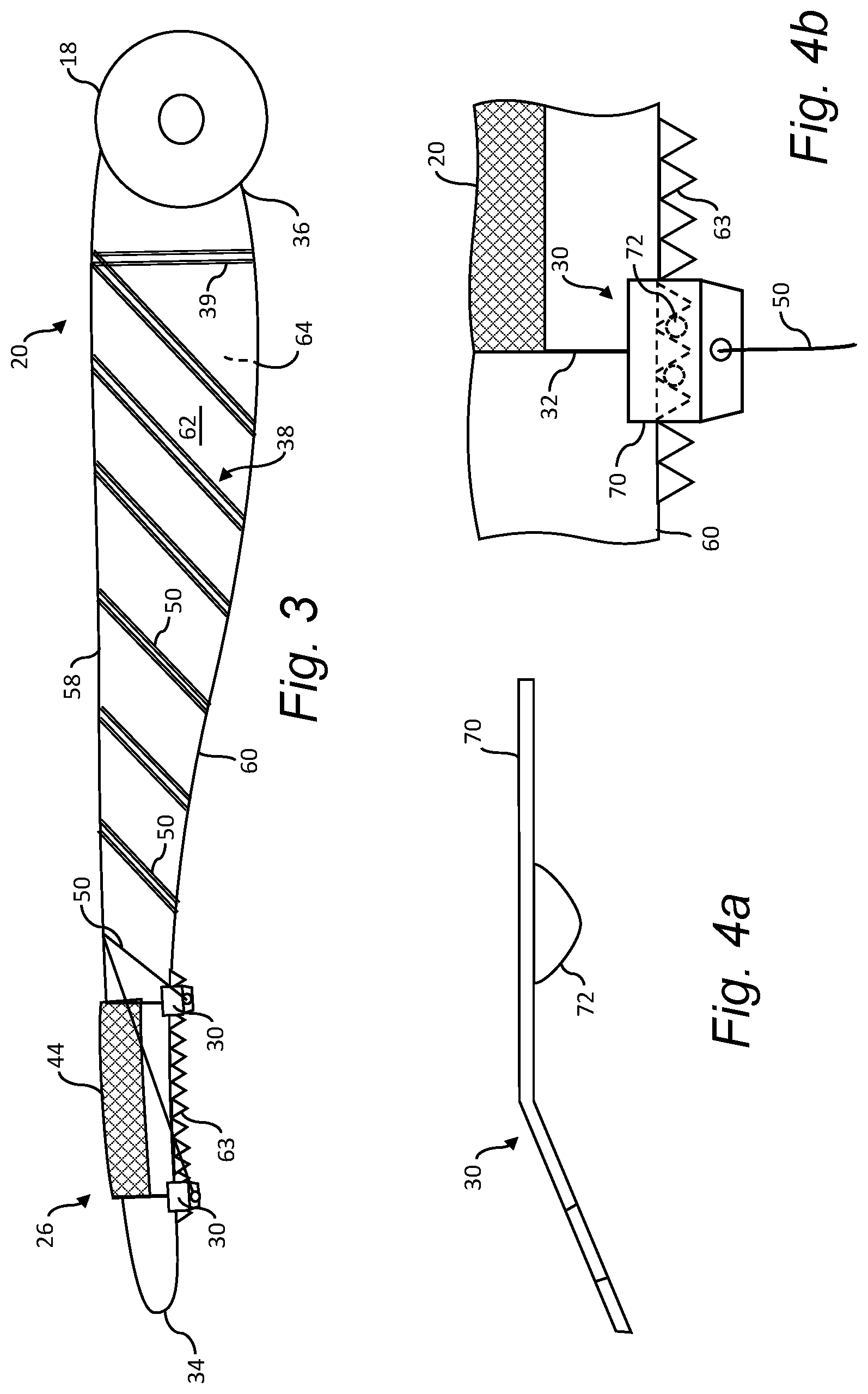 Patent US12098698 Figure 3 – System and method for installation of an open-sleeve add-on device on a wind turbine blade