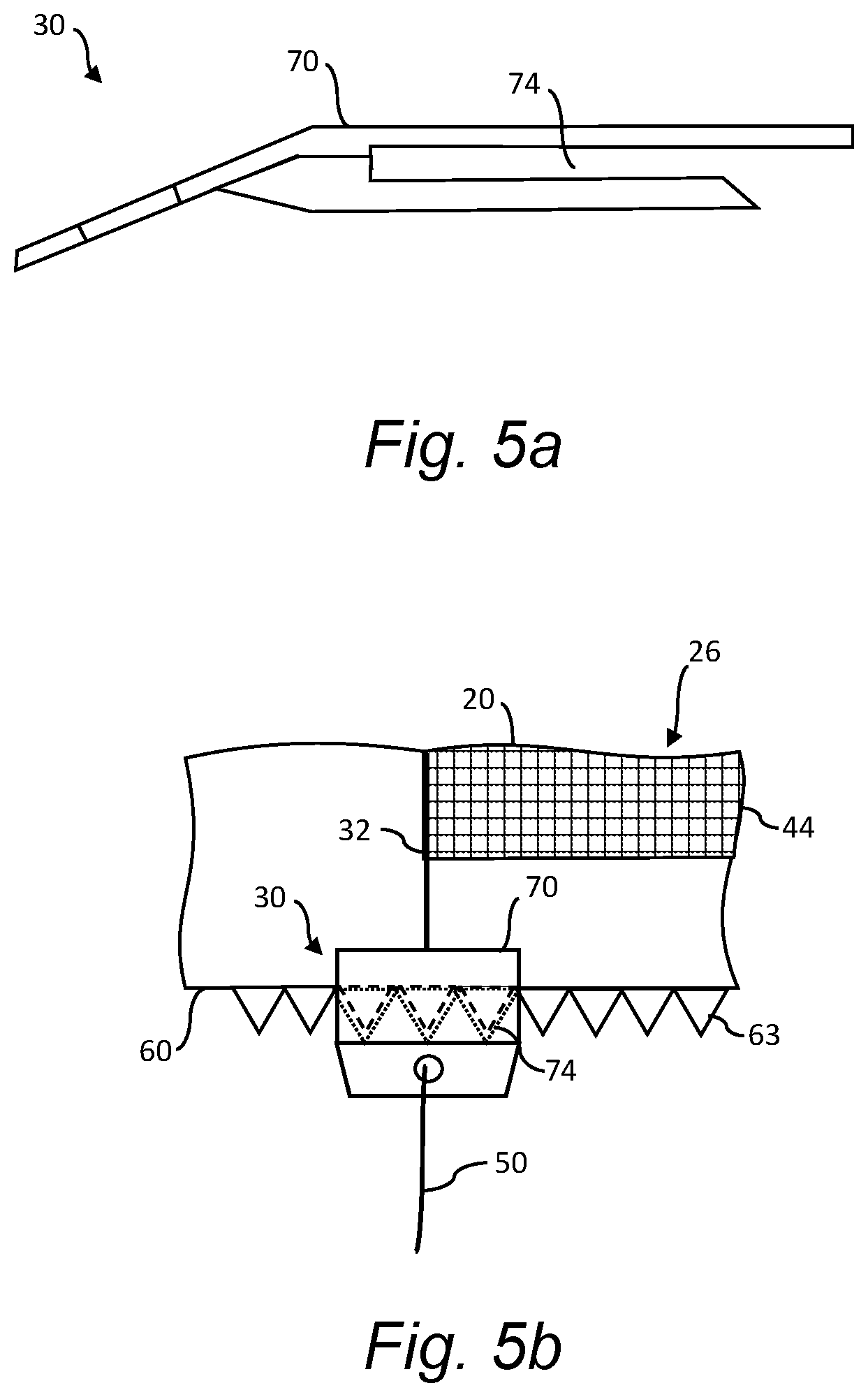 Patent US12098698 Figure 4 – System and method for installation of an open-sleeve add-on device on a wind turbine blade