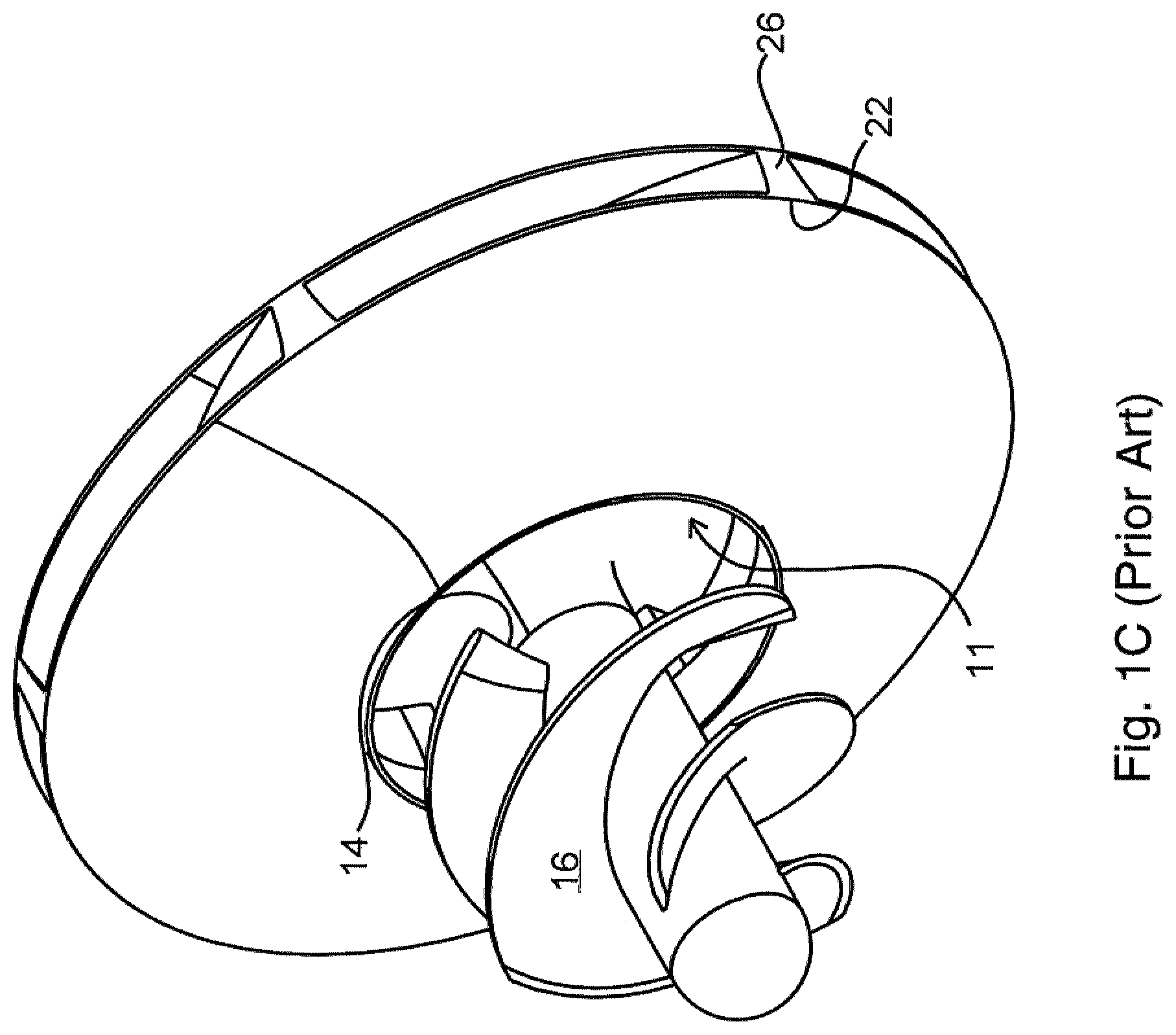 Patent US12098728 Figure 2 – Inducer for a submersible pump for pumping a slurry containing solids and viscous fluids and method of designing same